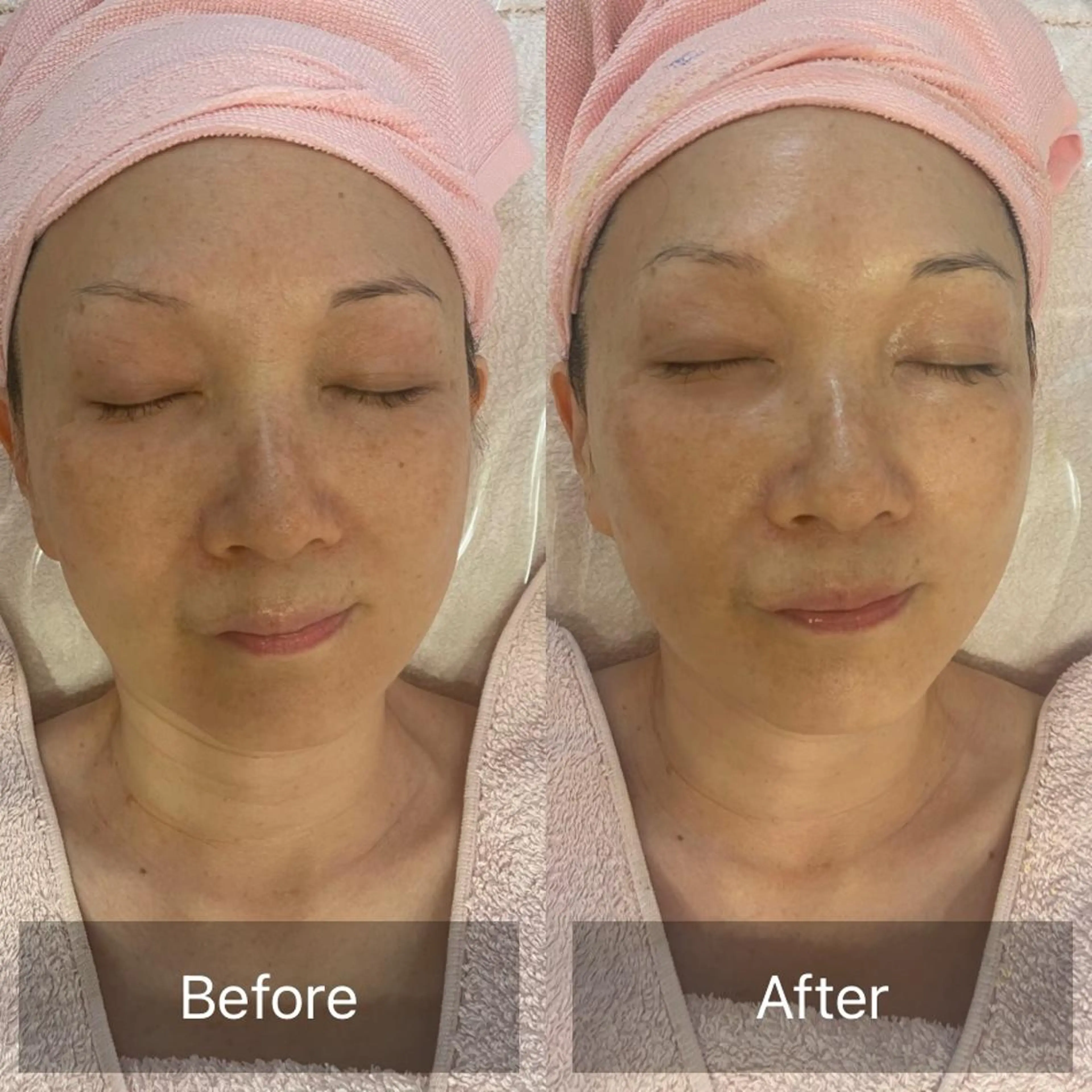 Lis Rose🥀 フェイシャルサロンのエステ・リラクイメージ