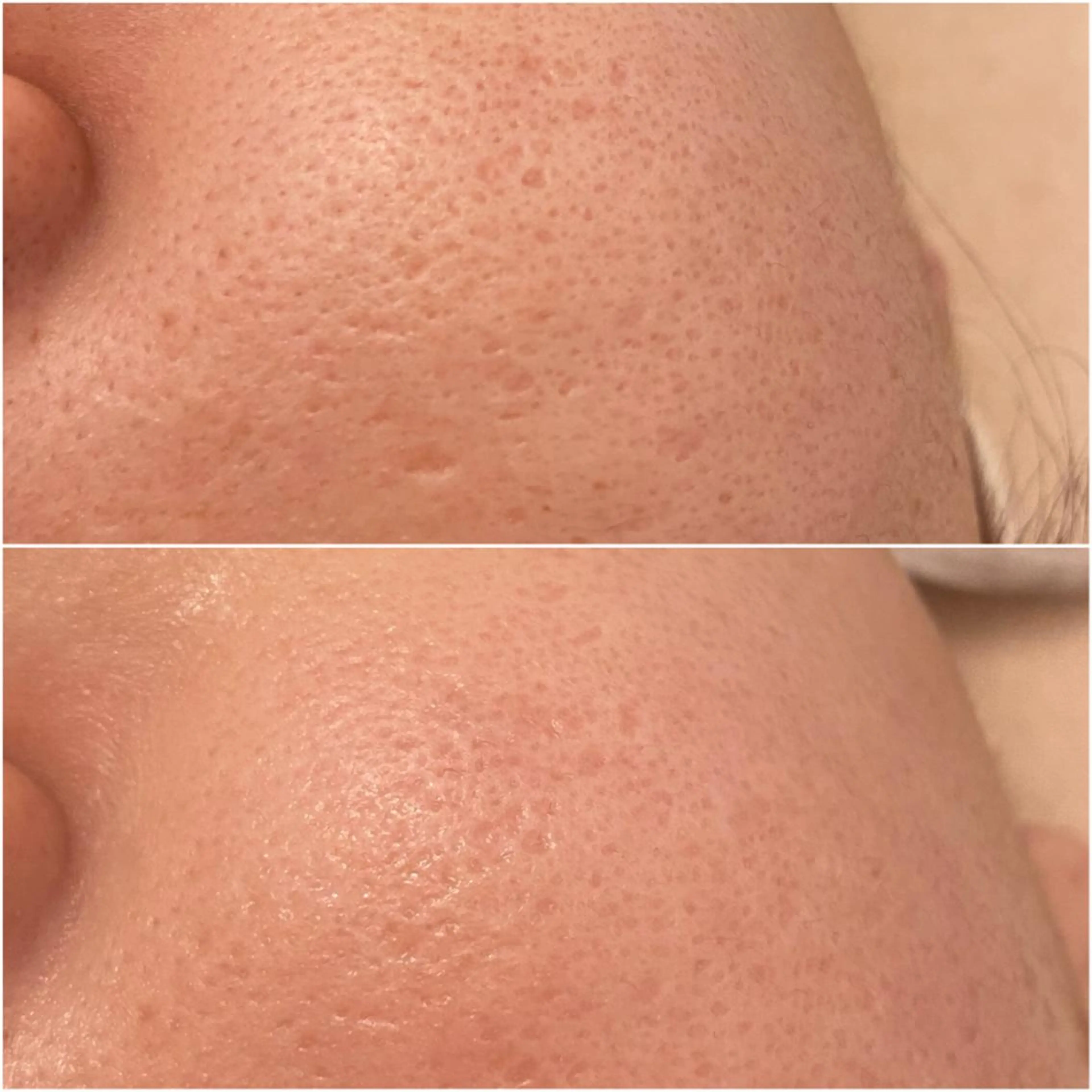 エステ ララ/ハーブ メゾンリュバンのエステ・リラクイメージ