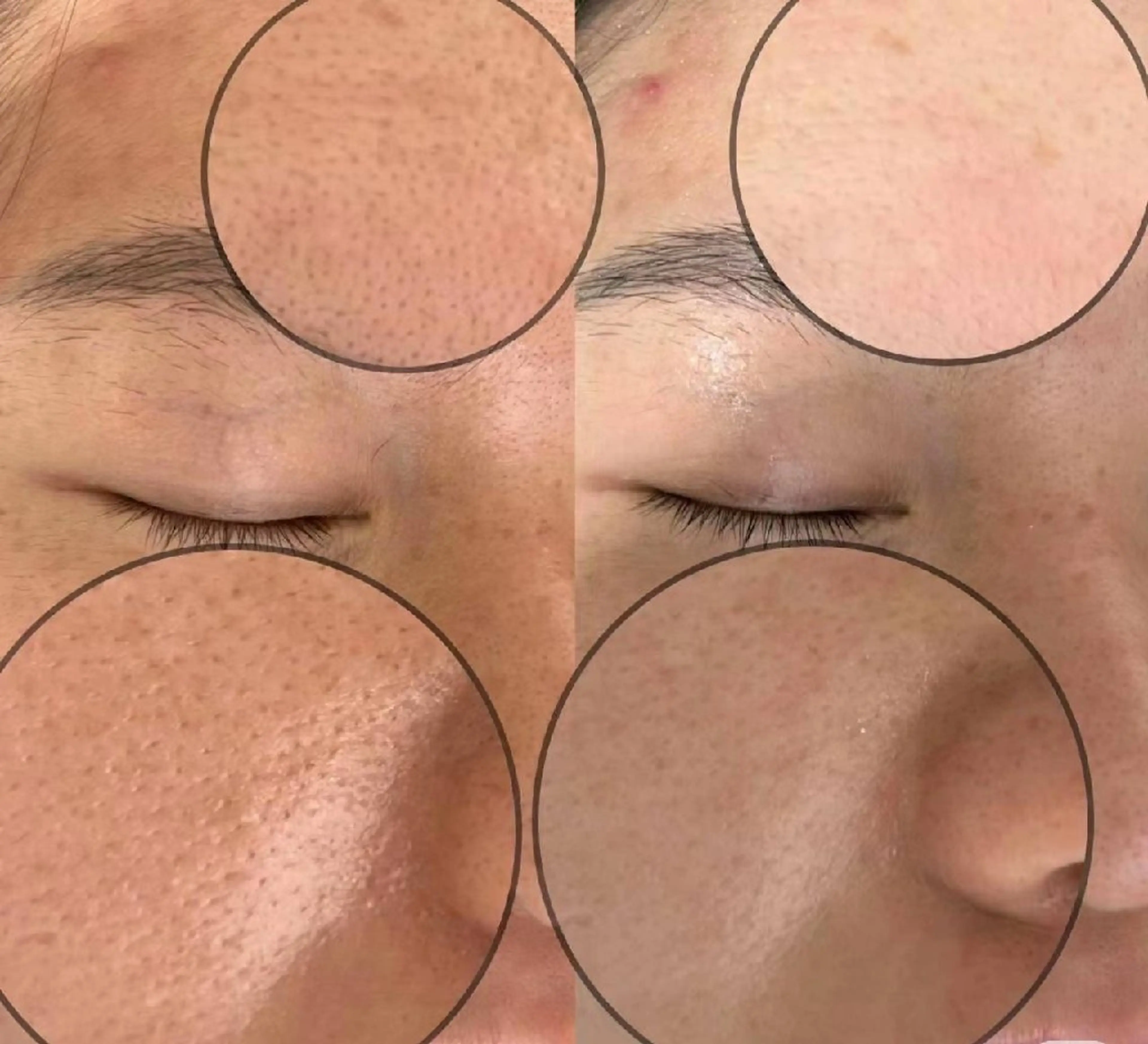 ネイル ブライダルネイル aliaハーブ水光店 エステティシャン募集のエステ・リラクイメージ