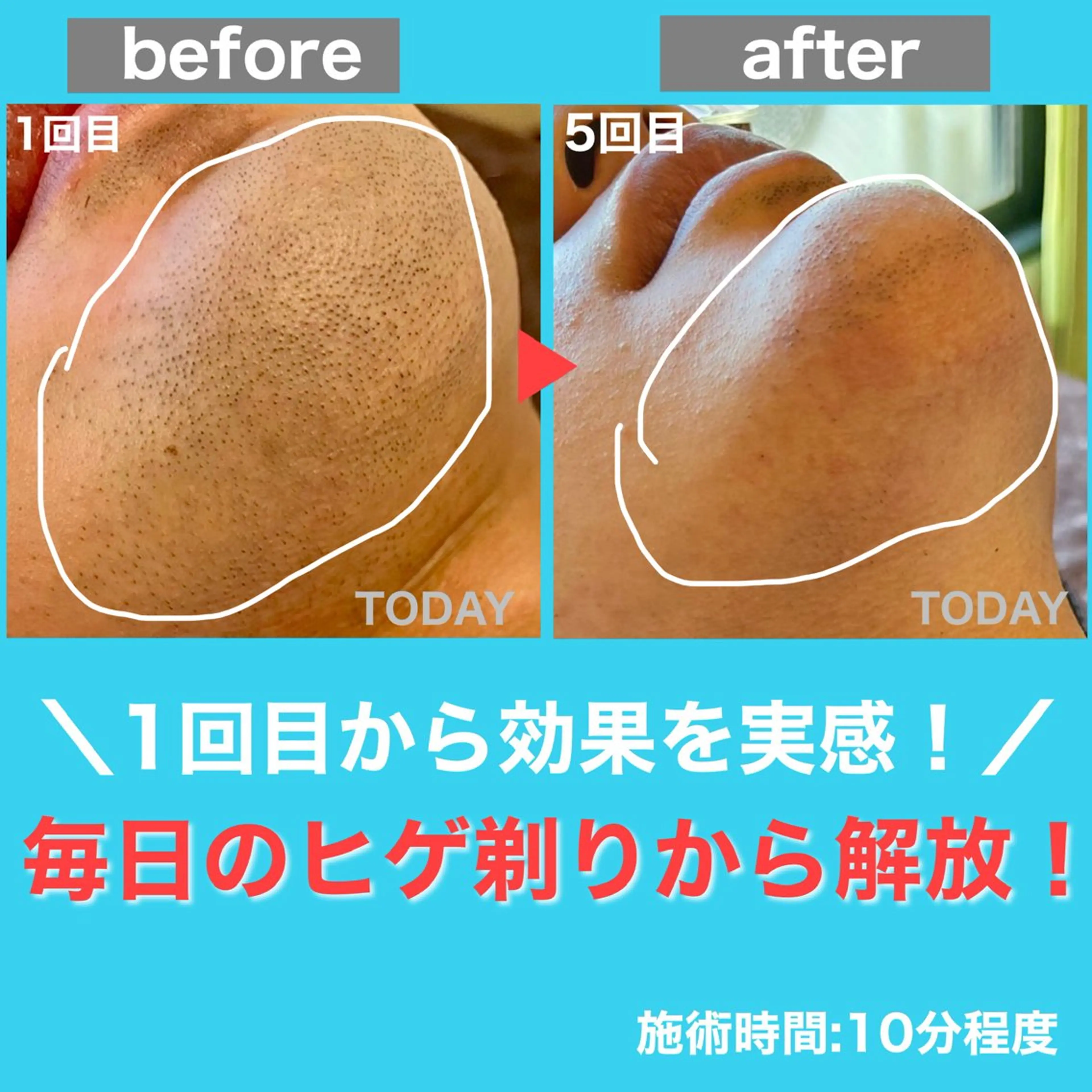 メンズ 【メンズ脱毛専門店】TODAY所属・都度払い制メンズ脱毛 オーナーのエステ・リラクイメージ