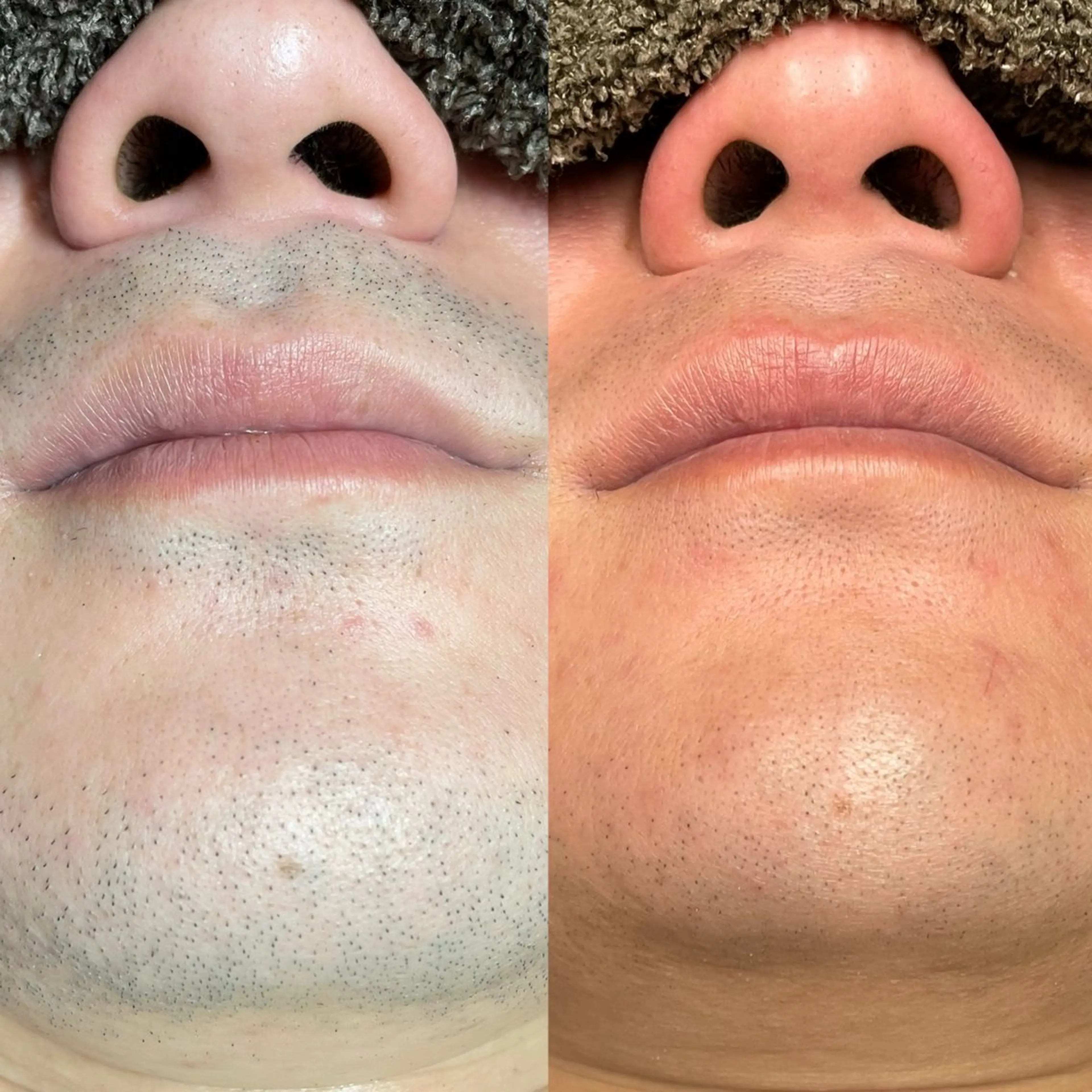 脱毛 高知駅前店　Tug AMIのエステ・リラクイメージ