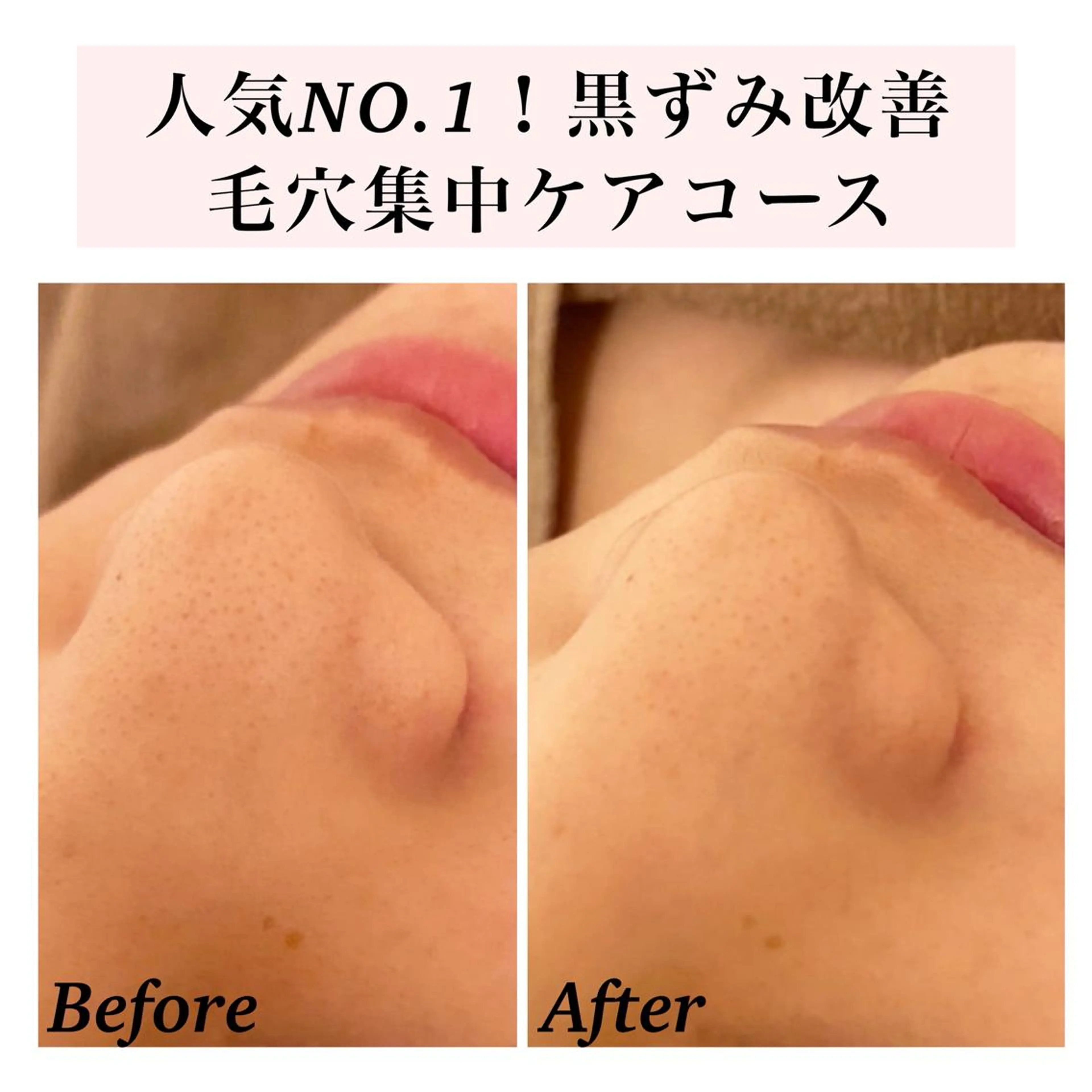 エステ リラク Bellesthe （ベルエステ）のエステ・リラクイメージ