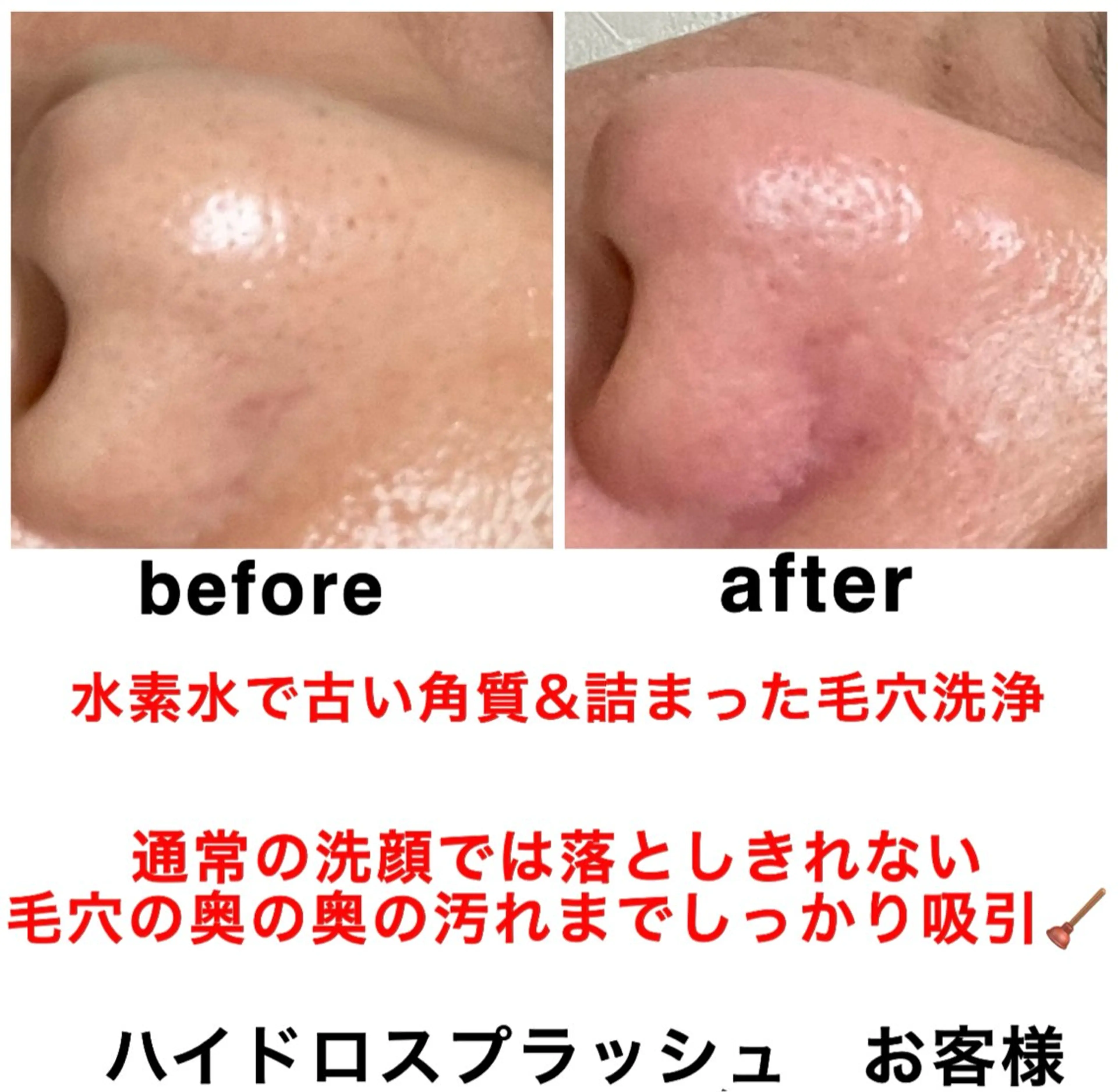 エステ リラク ネイル・エステサロン UILANIのネイルデザイン