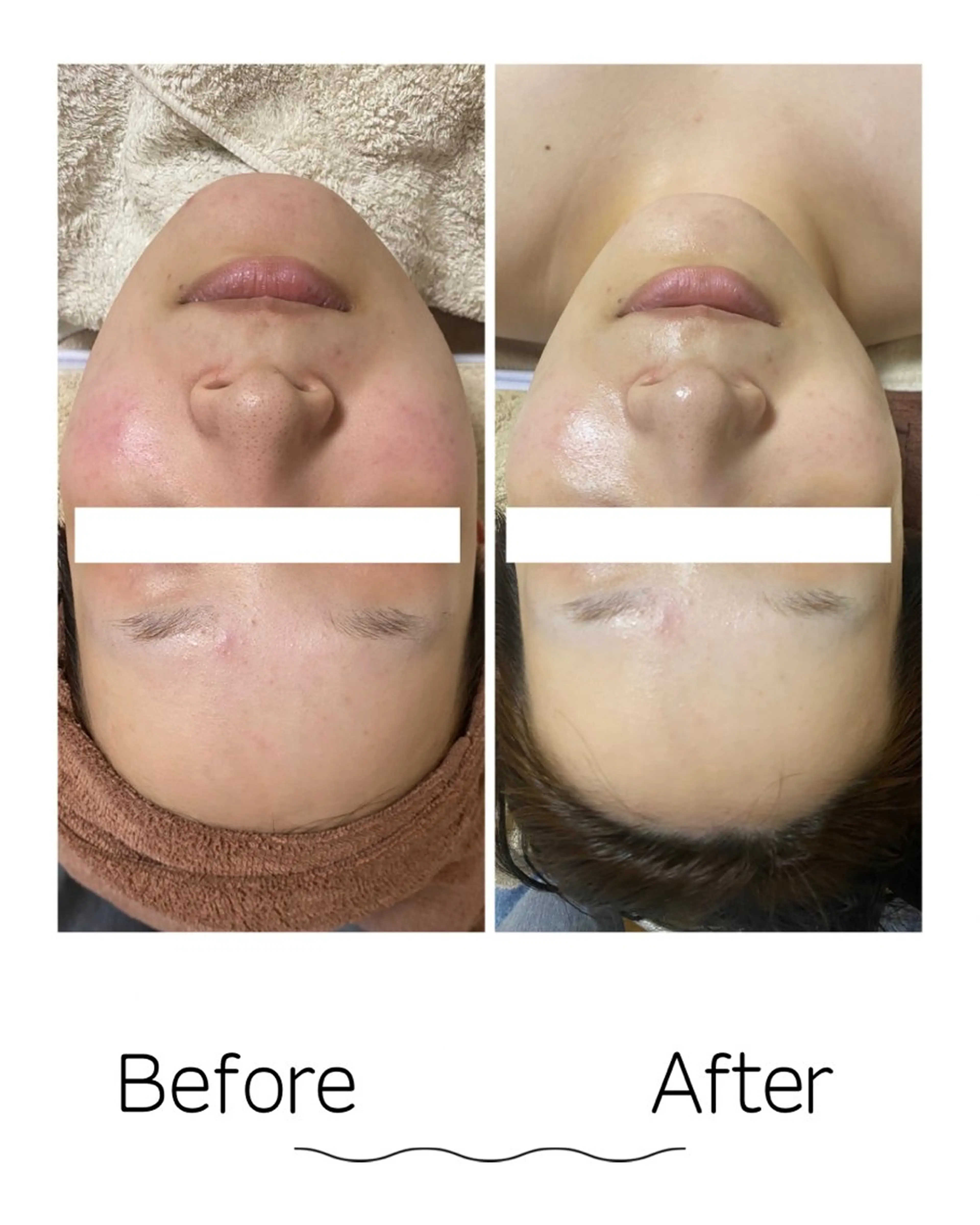 エステ Linoa所属・Linoa（リノア） エステ&リラクのエステ・リラクイメージ