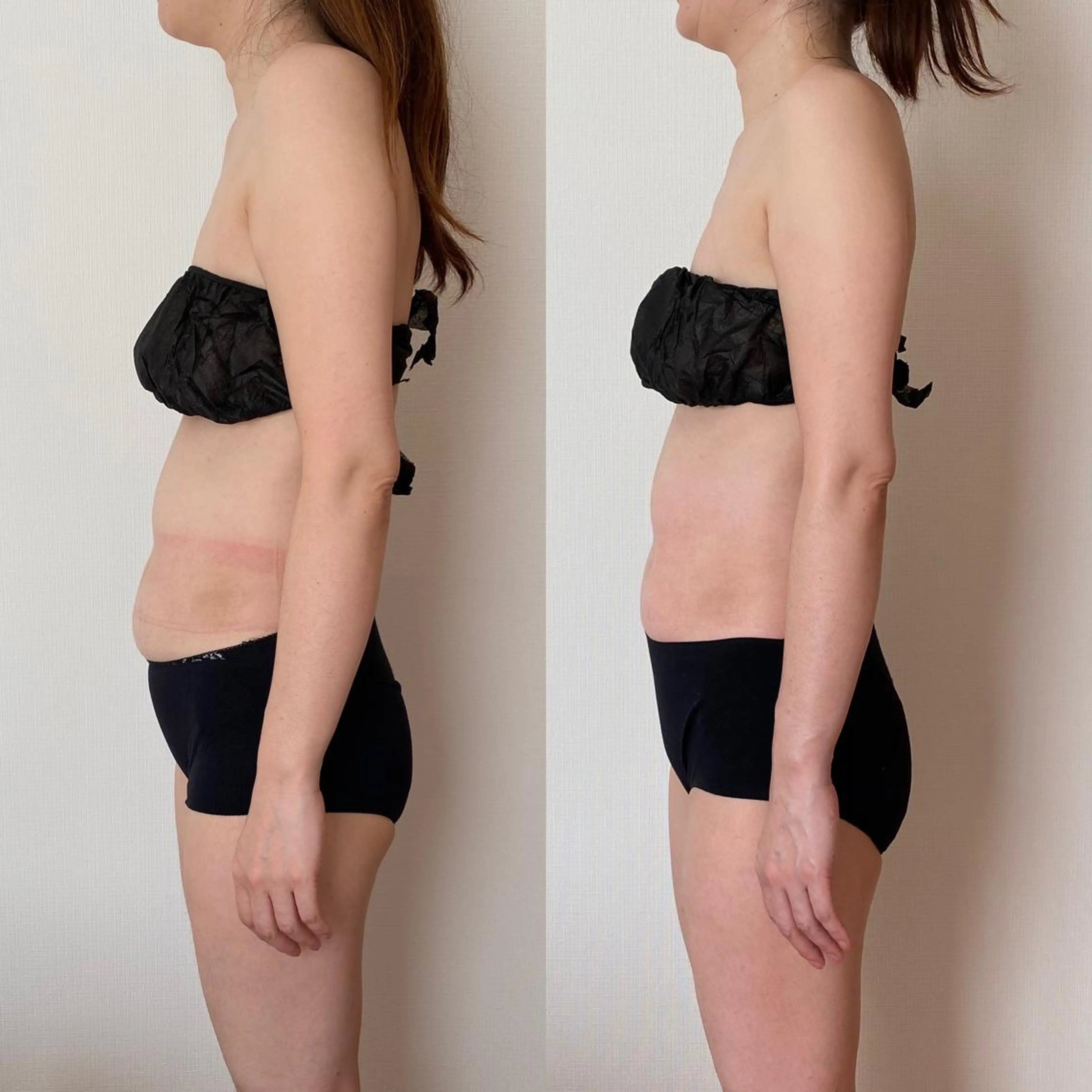 【毎月5名様限定】「お腹痩せ」コース★腸もみでぽっこりお腹すっきり！60分◆通常体験価格¥8,600→特別体験価格にて。の写真