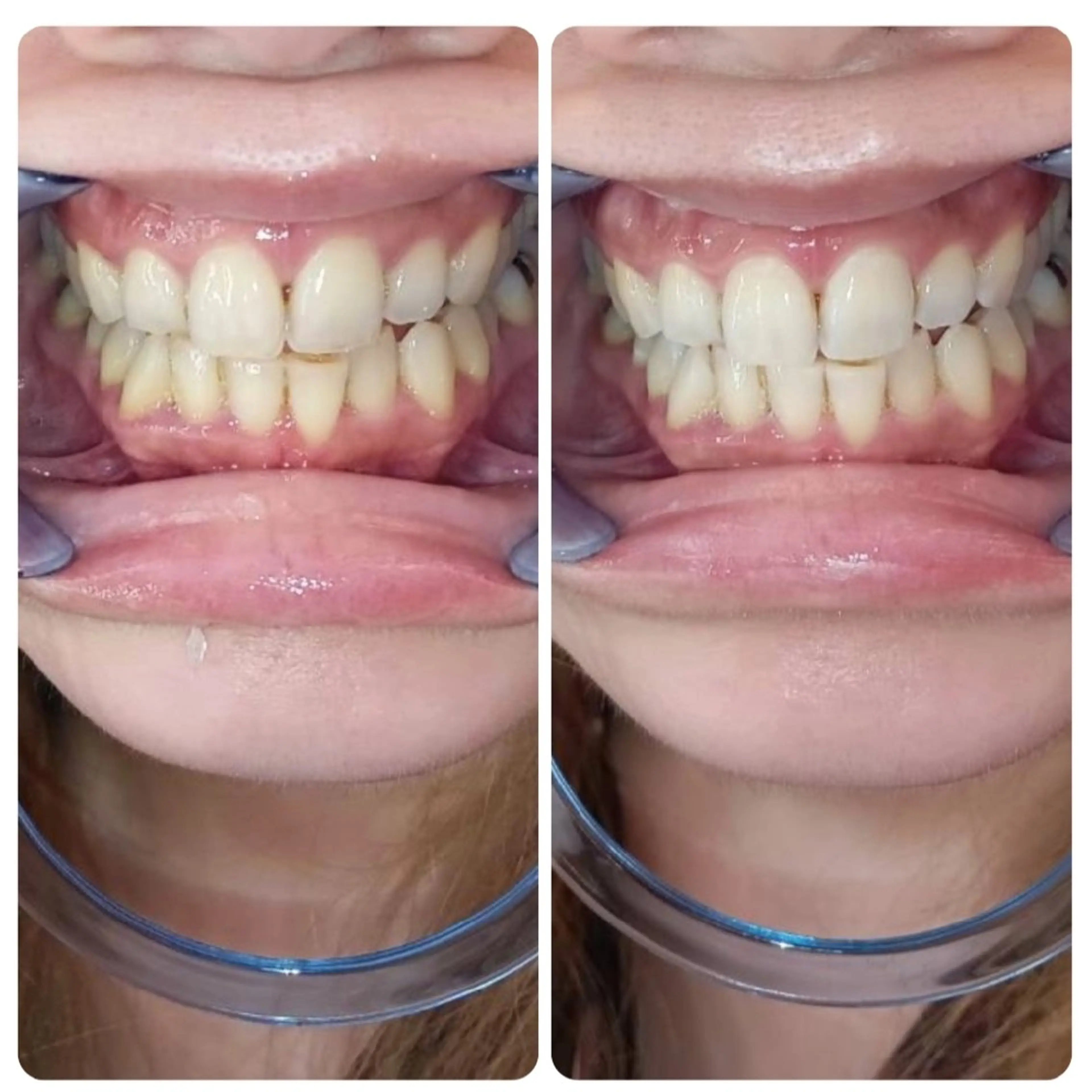 エステ A-family  kaoriのエステ・リラクイメージ