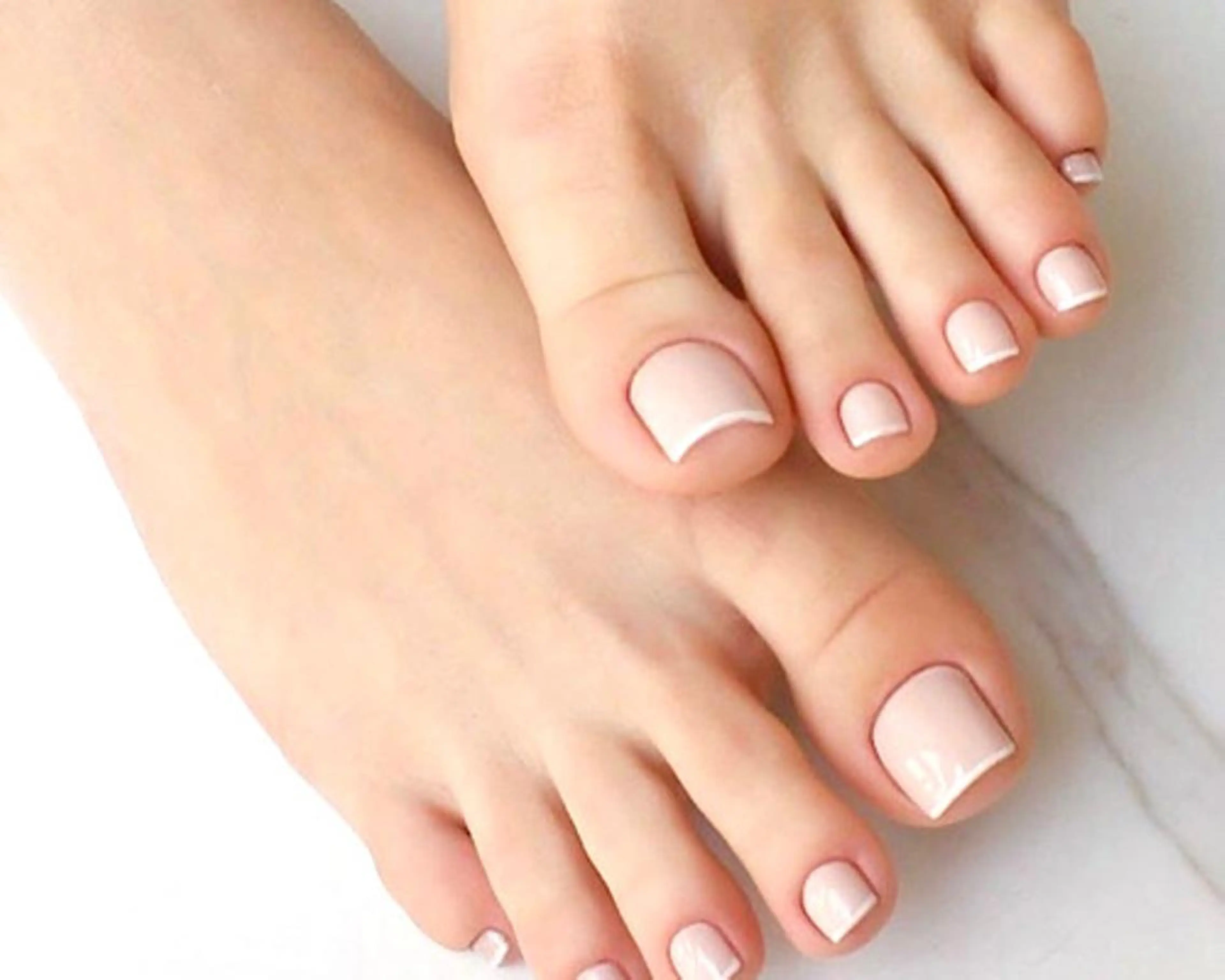 foot 親指 巻き爪矯正の写真