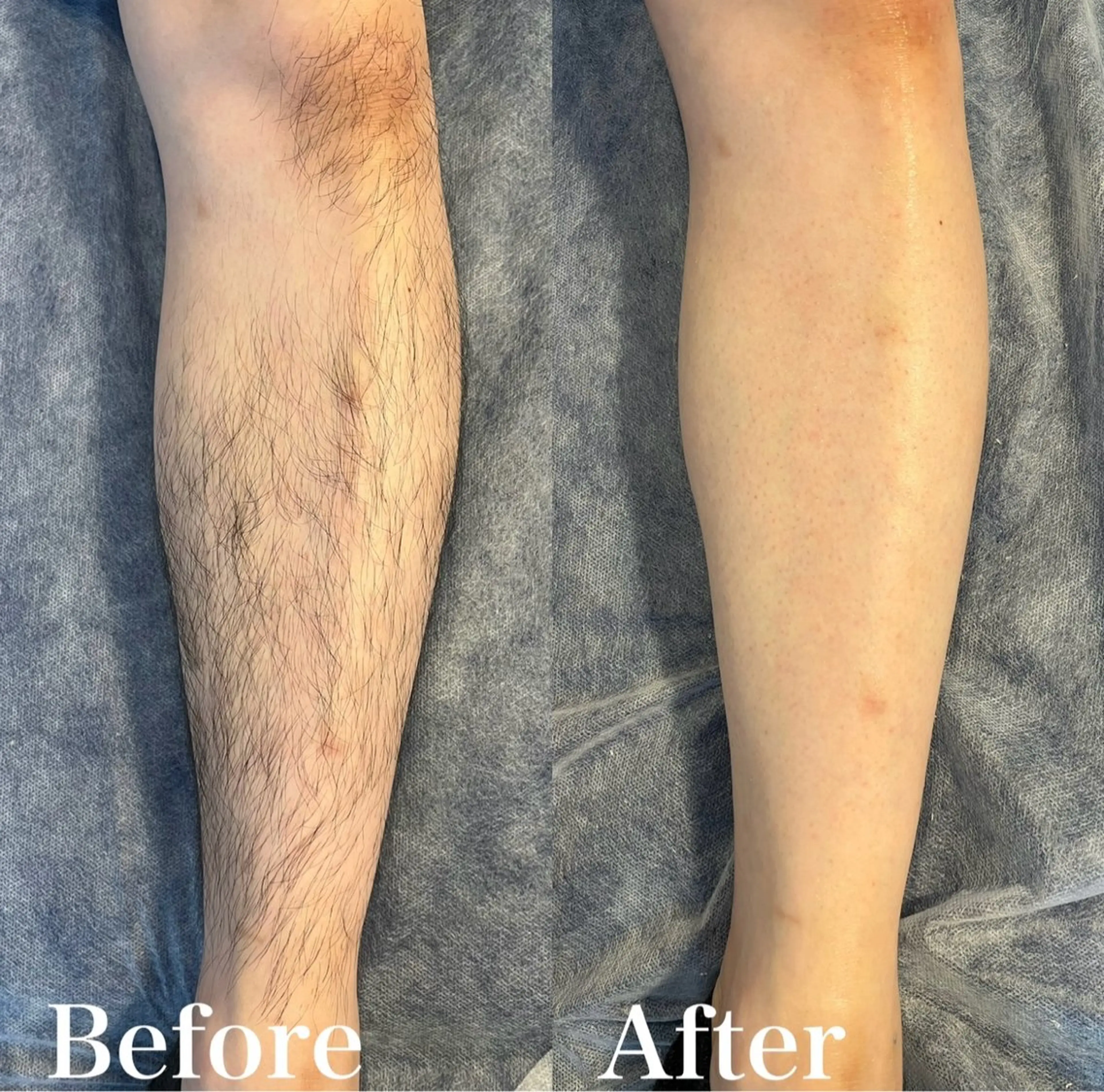 メンズ wax脱毛専門店 ハイラントのエステ・リラクイメージ