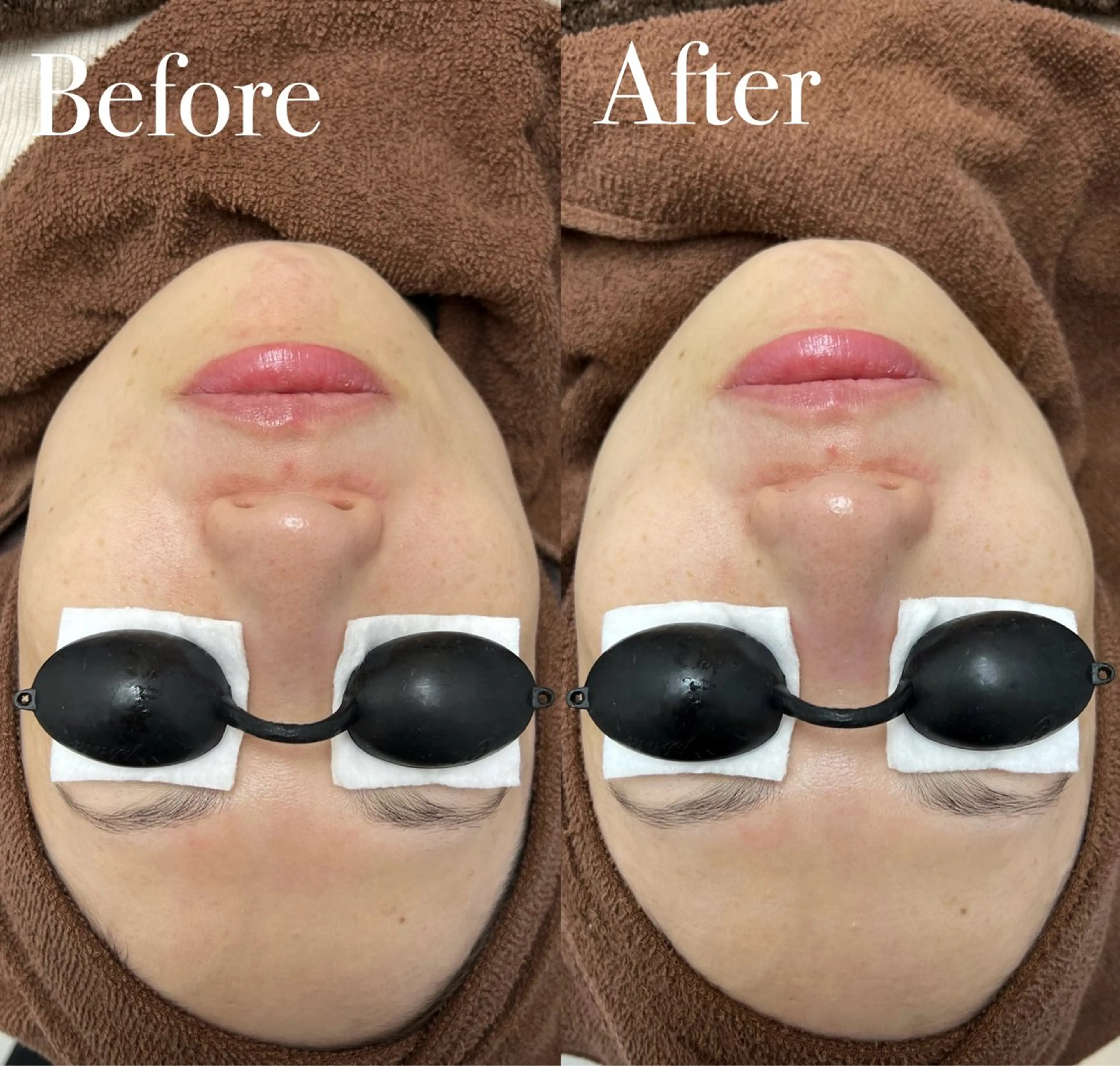 エステ プライベートサロン リプレイスのエステ・リラクイメージ