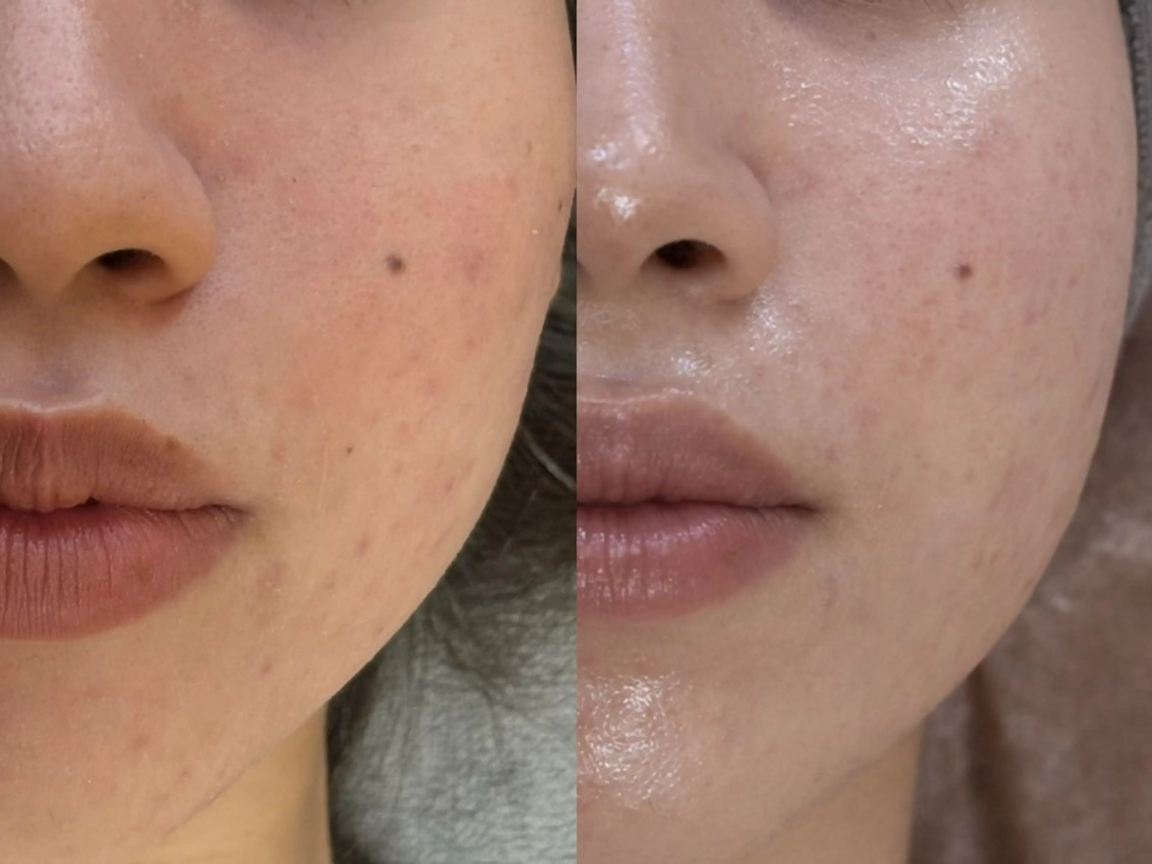 エステ リラク 艶肌デトックス🫧 Samiraのエステ・リラクイメージ