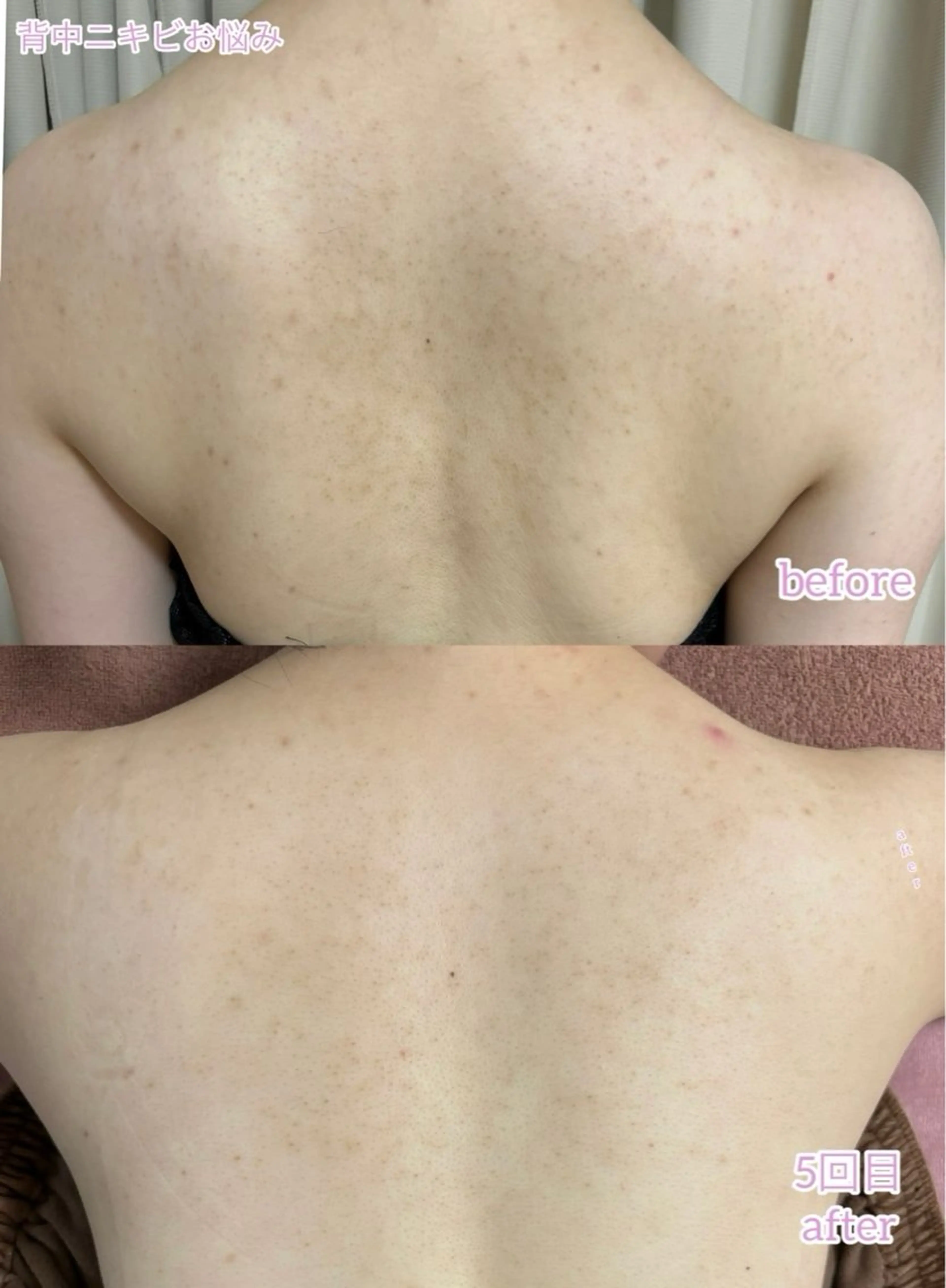 エステ リラク Linomalie エステ/たるみ/脱毛のエステ・リラクイメージ