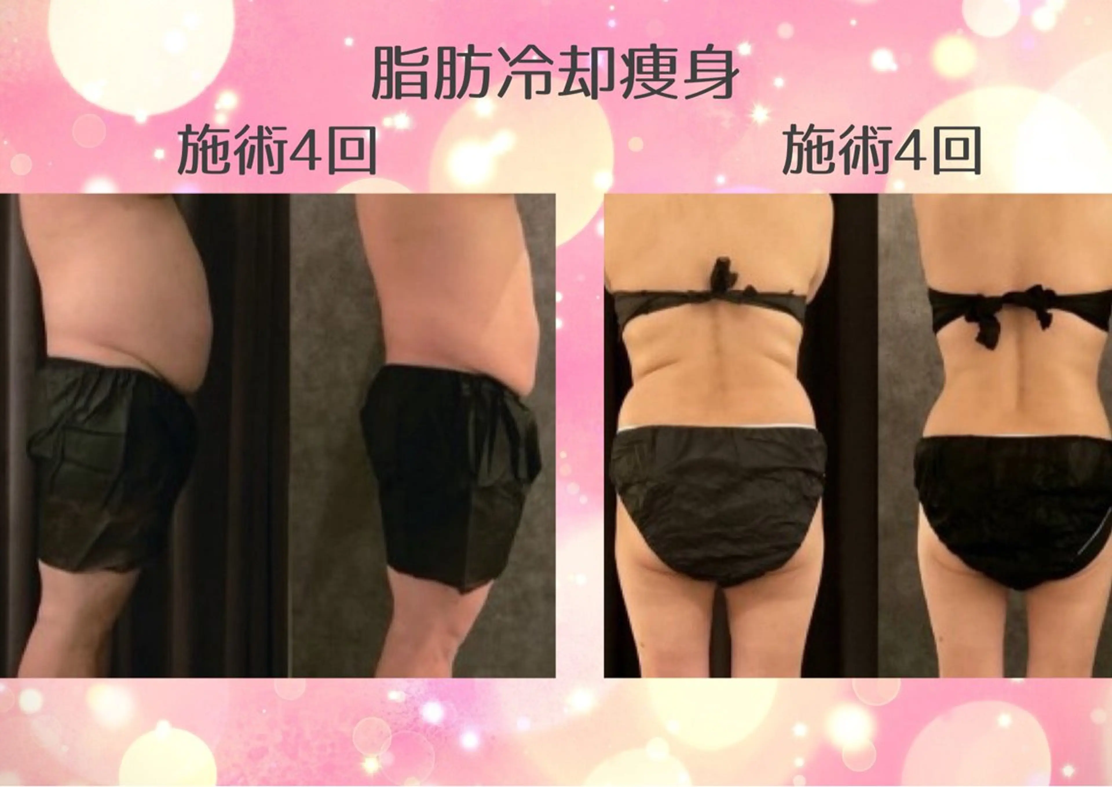 マツエク・マツパ エステ リラク 愛維美水光美肌専門店 メンズレディースokのエステ・リラクイメージ