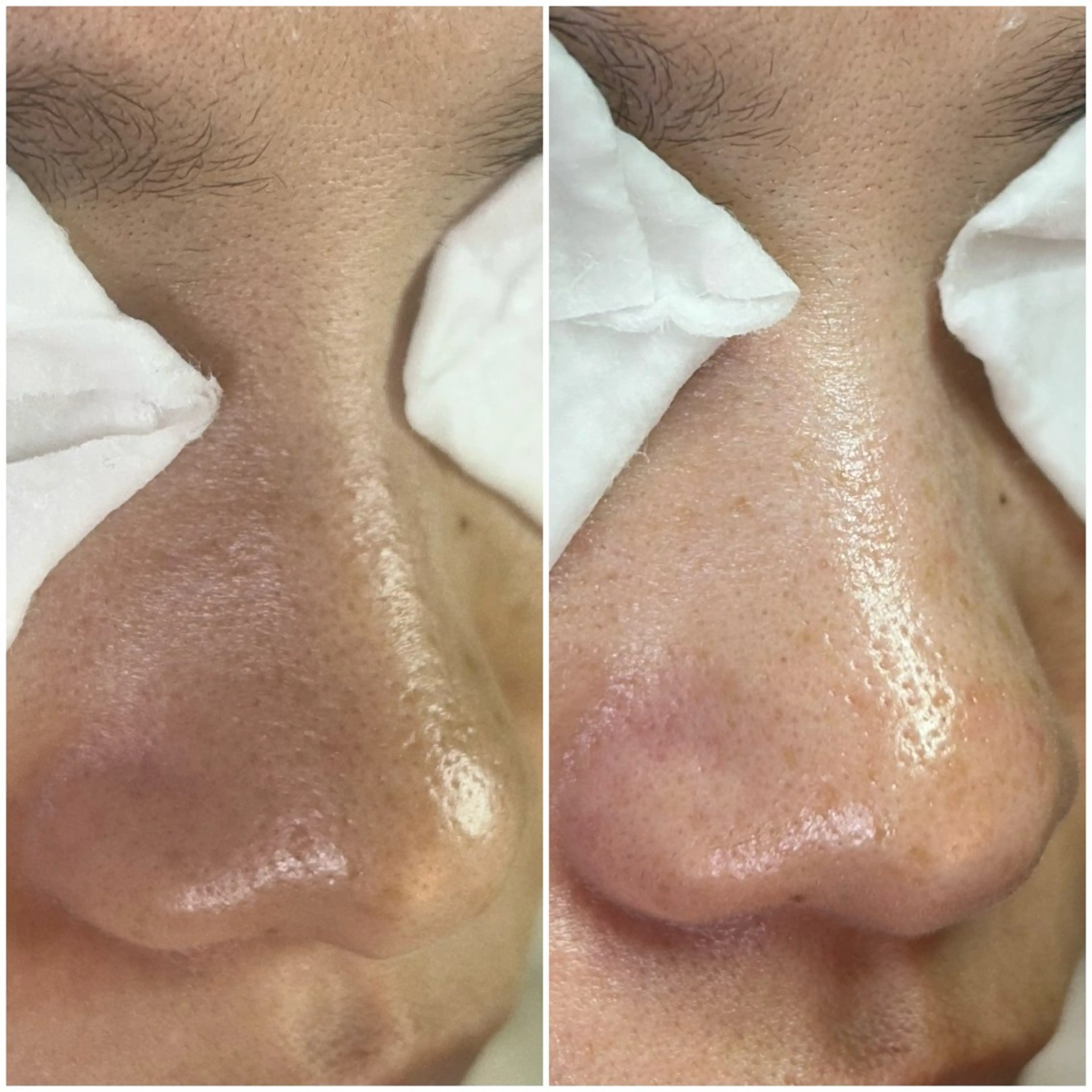 エステ 毛穴洗浄専門店/ 泉佐野/oluoluのエステ・リラクイメージ