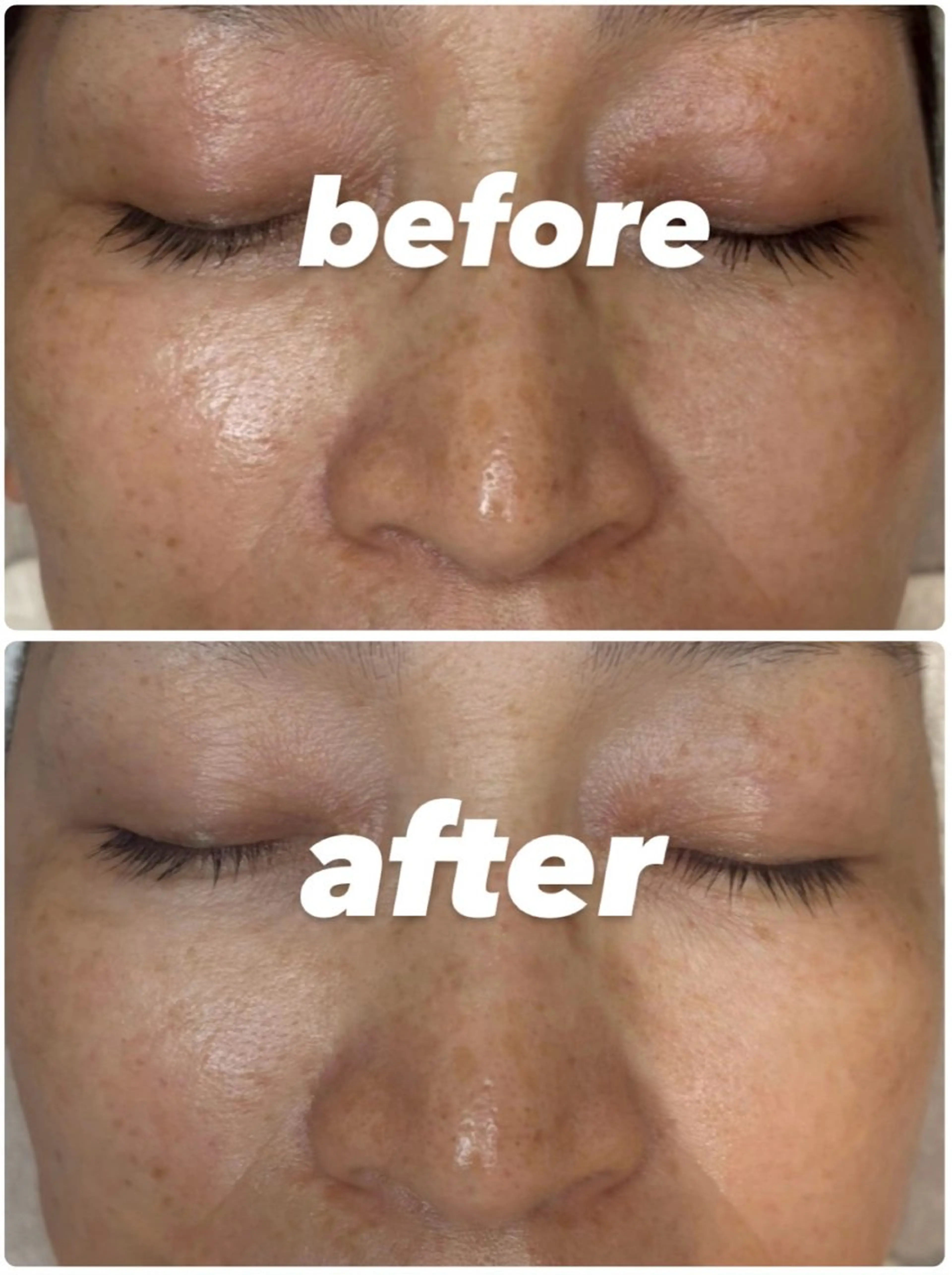 エステ リラク 肌管理🌿毛穴改善 POLA堺東のエステ・リラクイメージ