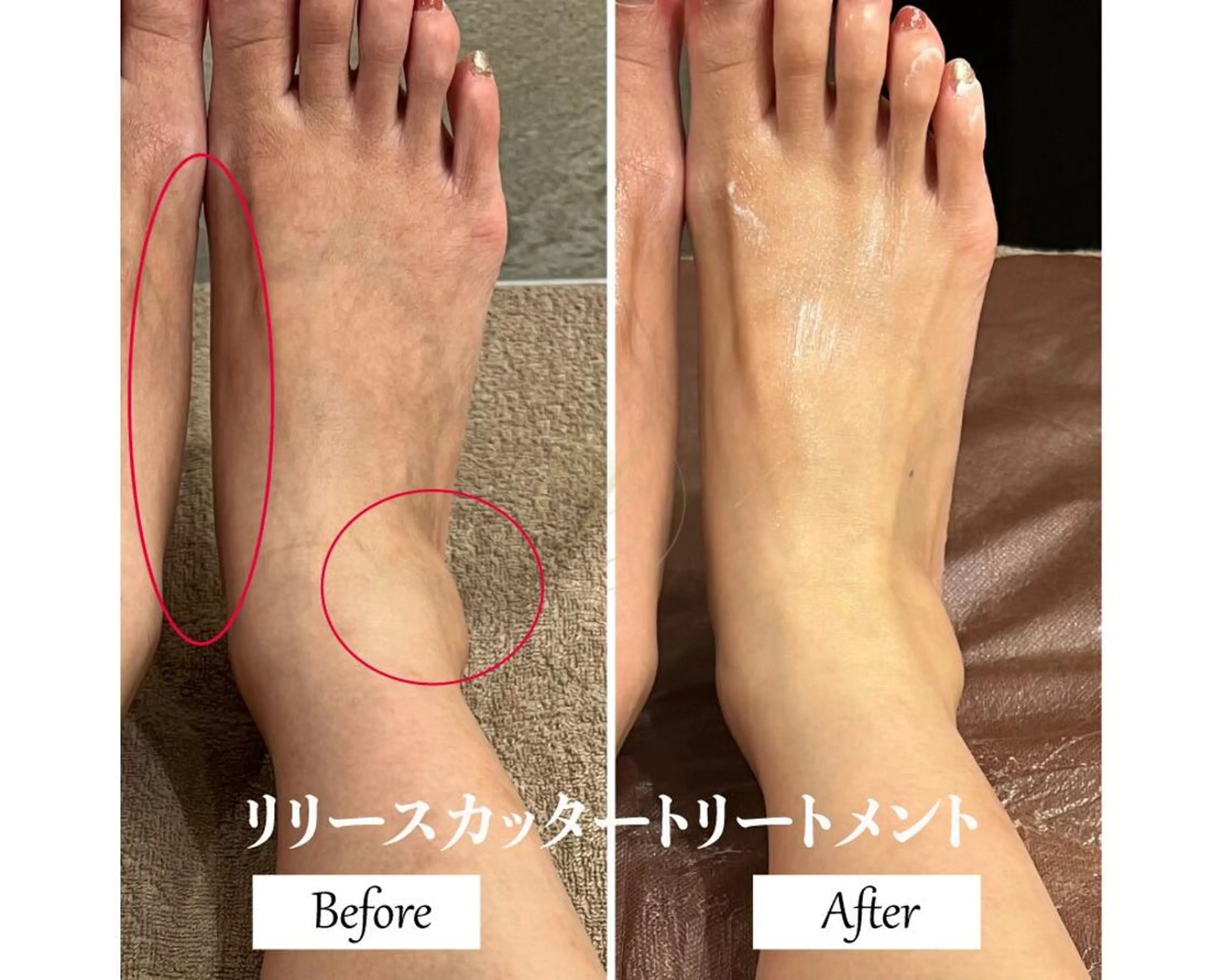 ブライダルサロン ｜Lino【堀江】のエステ・リラクイメージ