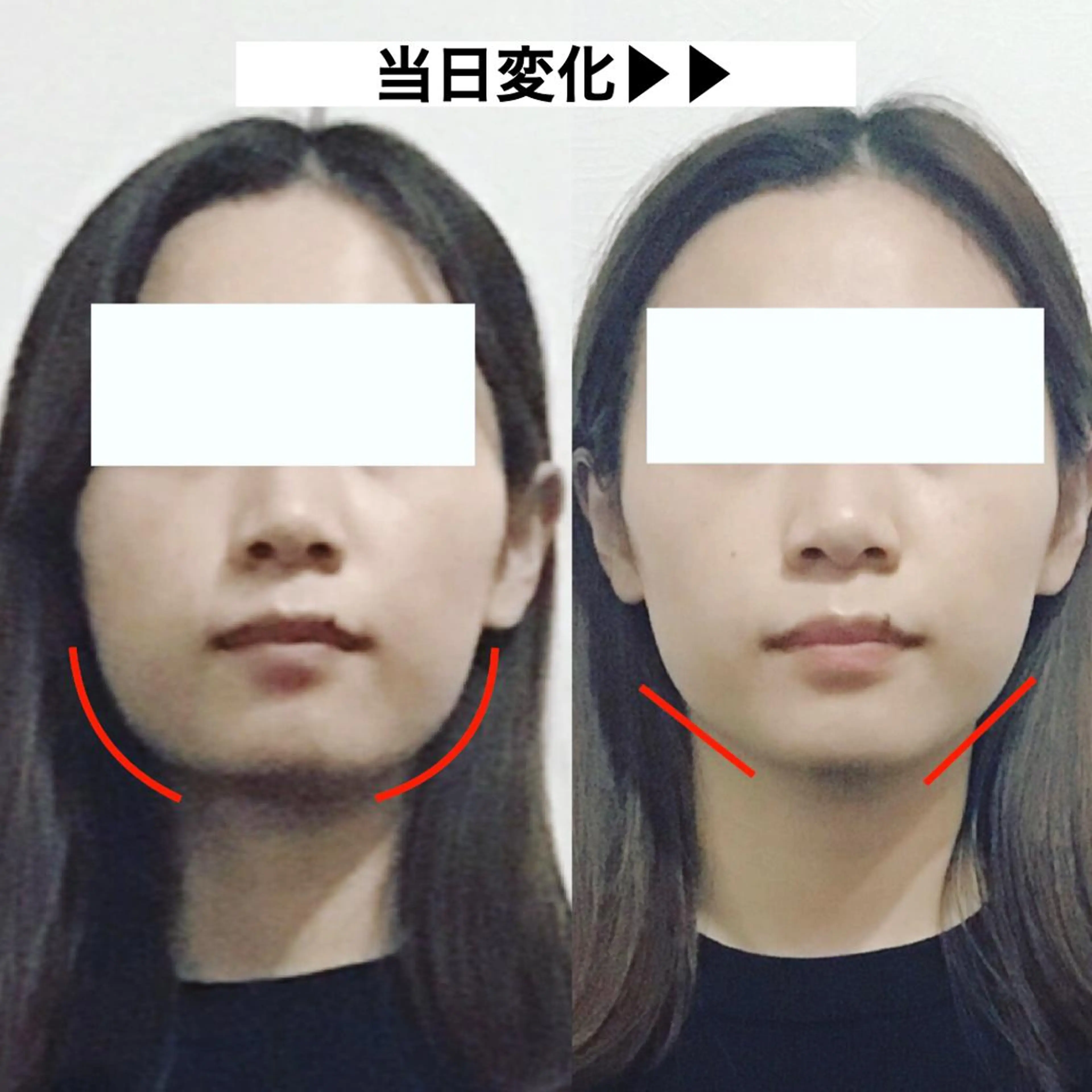 顔の歪み矯正専門 宮内翔のエステ・リラクイメージ