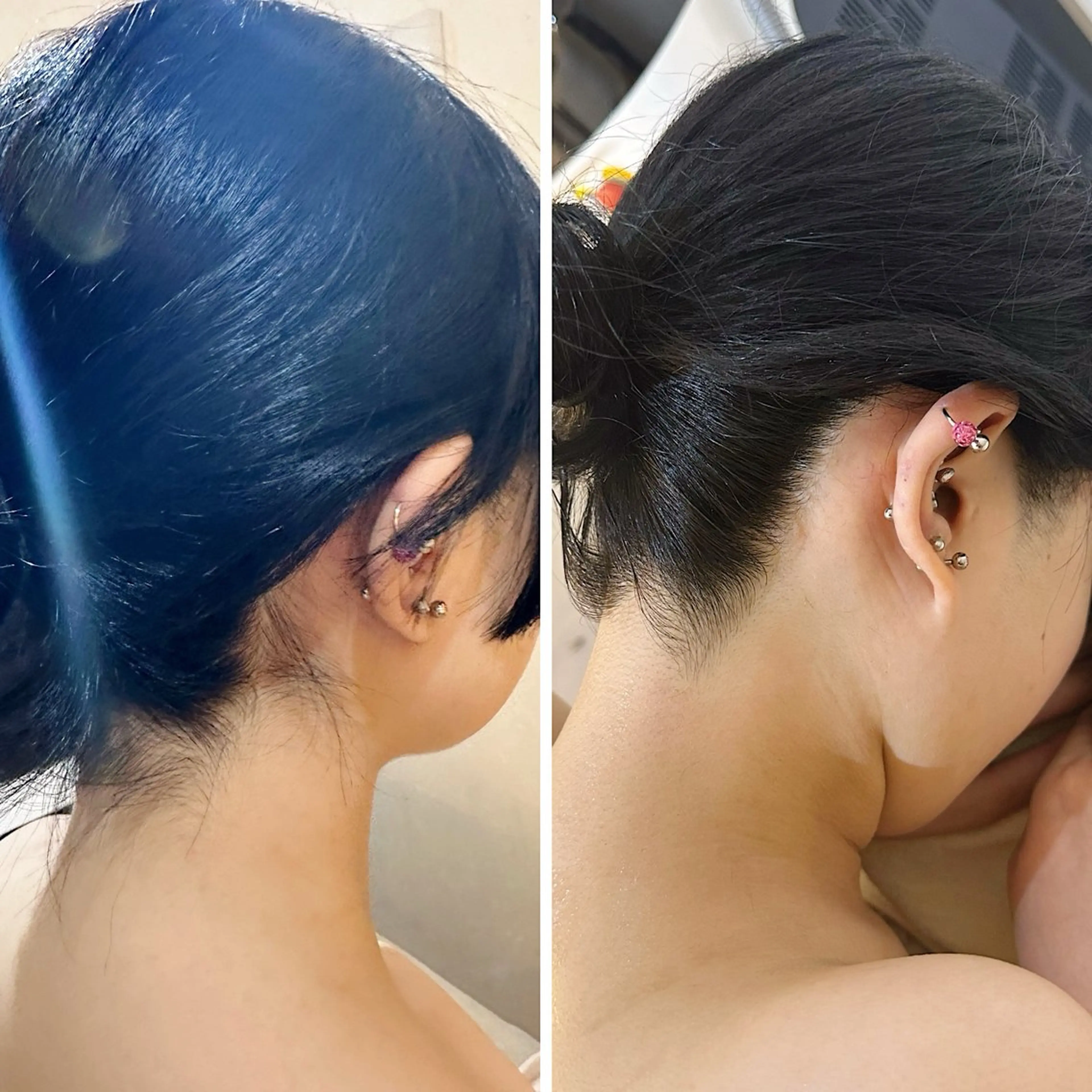 脱毛 うなじ脱毛/美肌脱毛 LABELのエステ・リラクイメージ