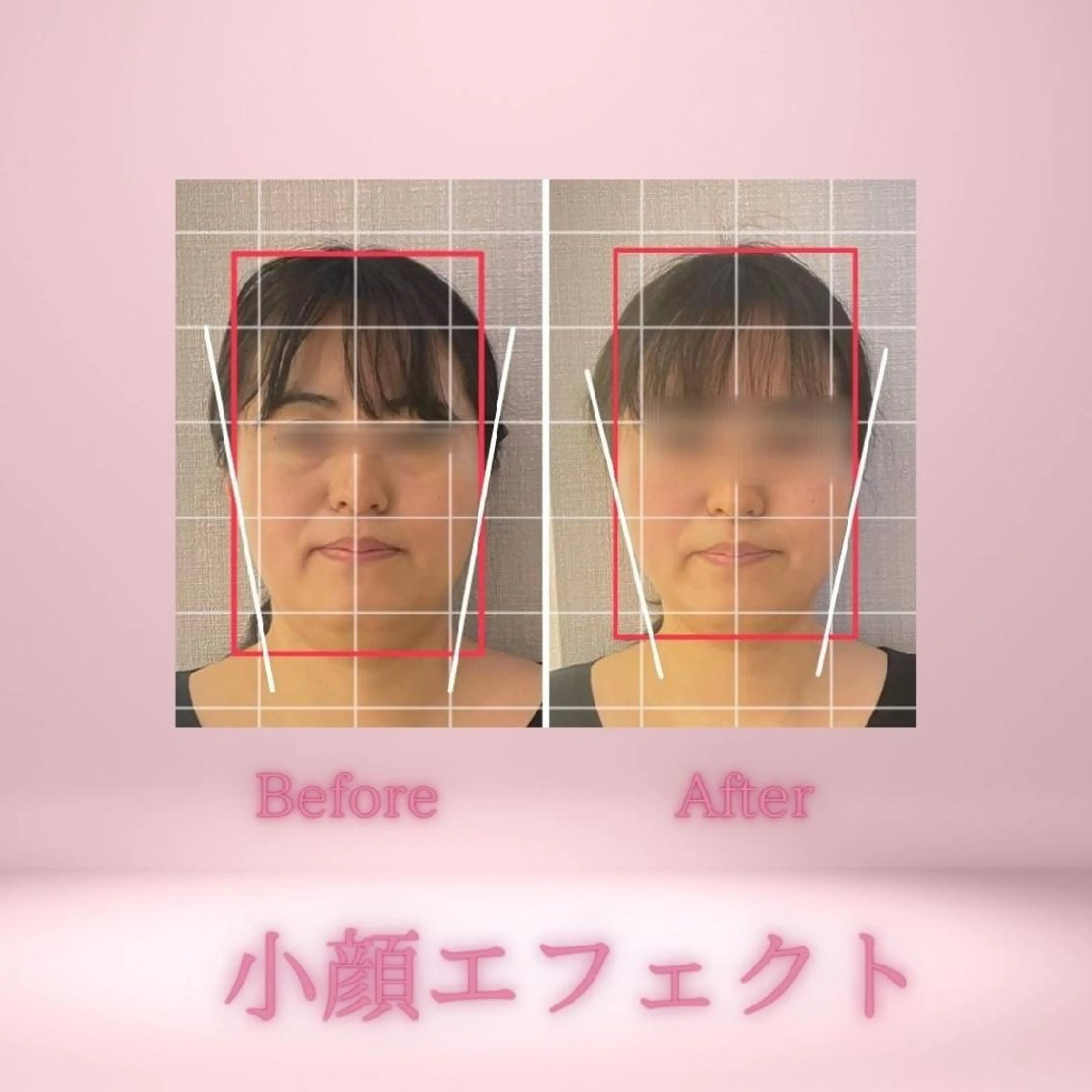 小顔・肌悩み専門店 ボーテドリッシュのエステ・リラクイメージ