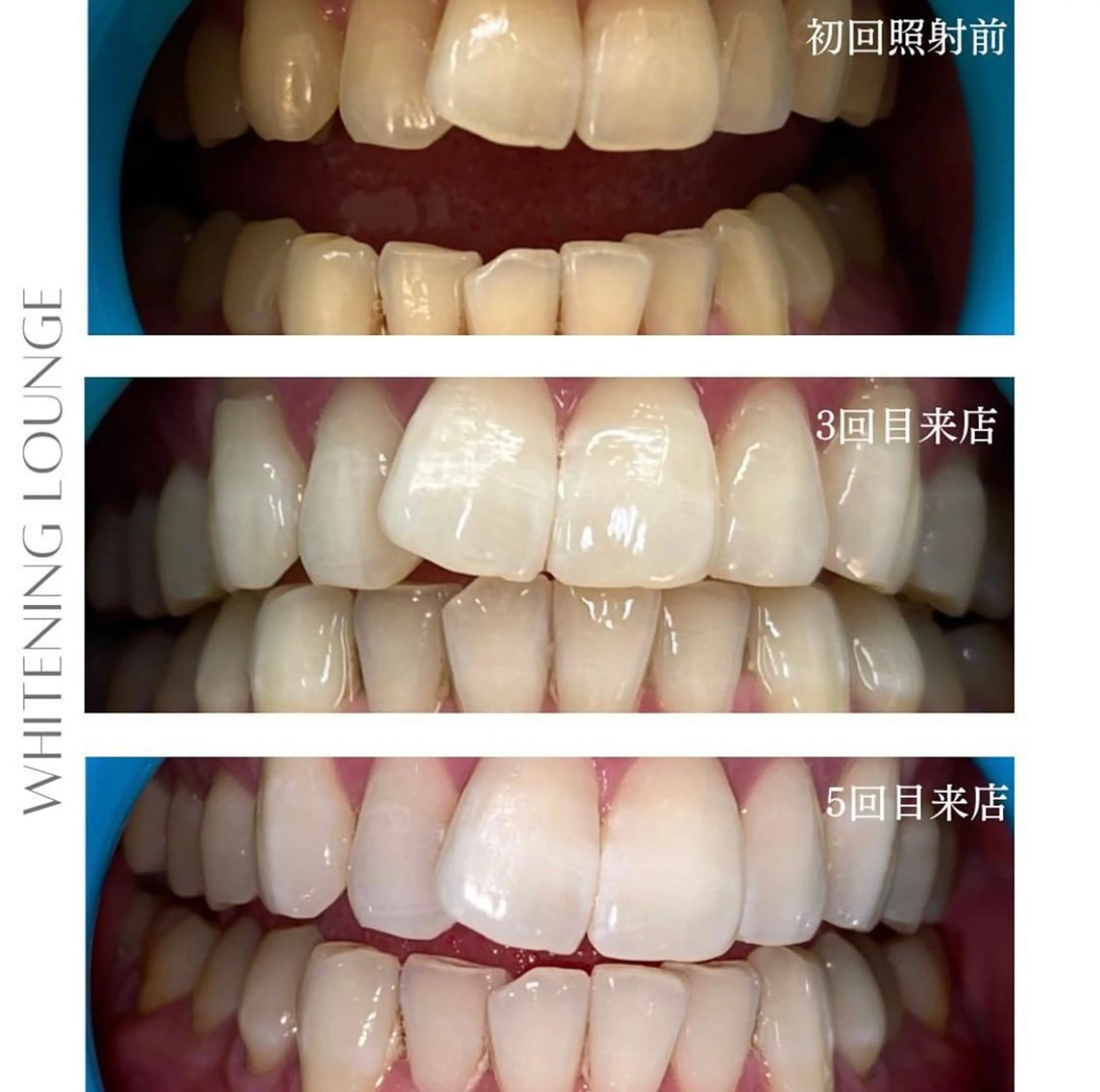 ホワイトニングラウンジ横須賀所属・ホワイトニング Lounge横須賀のエステ・リラクイメージ