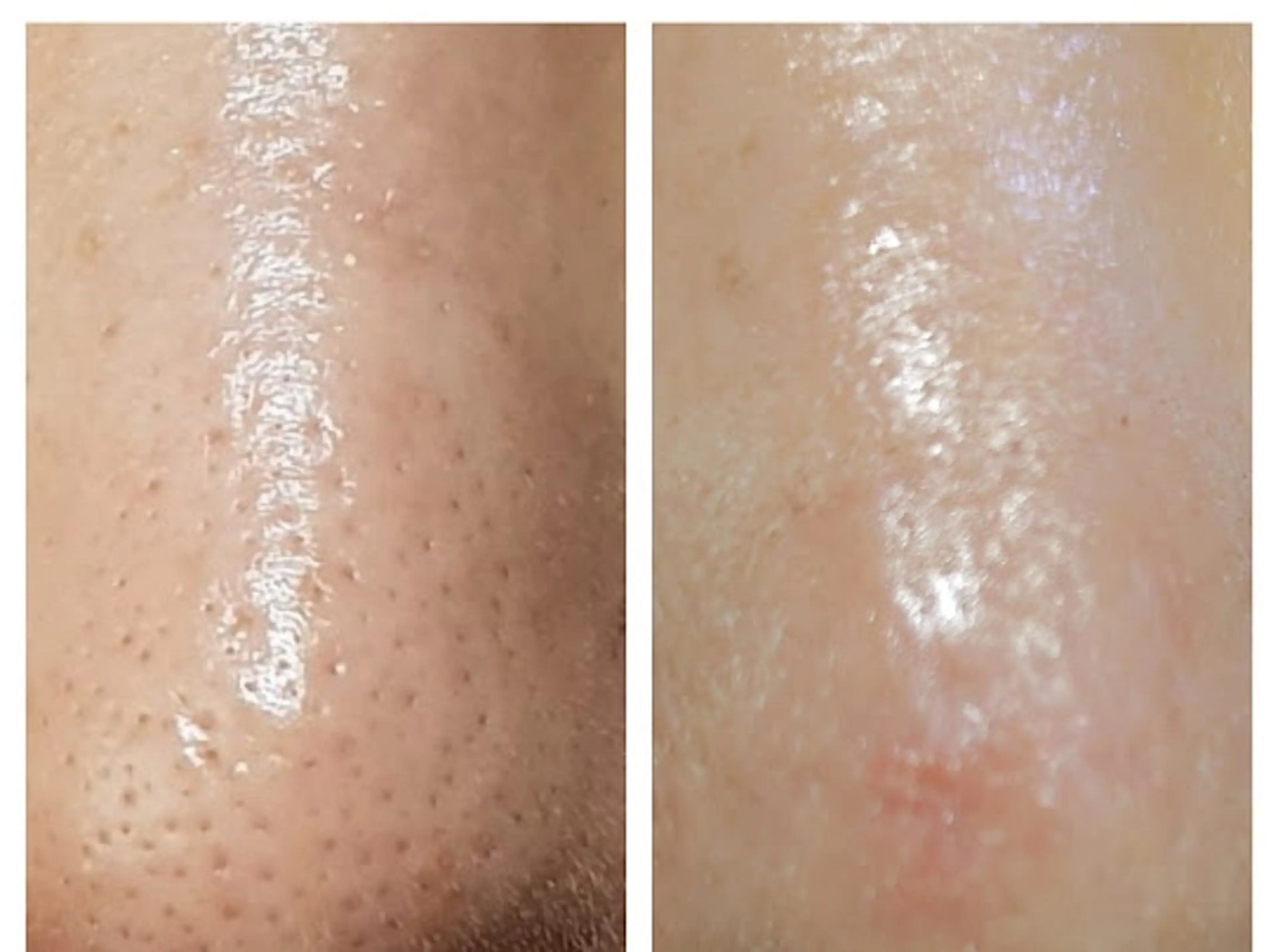 エステ プライベートサロン VIALLのエステ・リラクイメージ