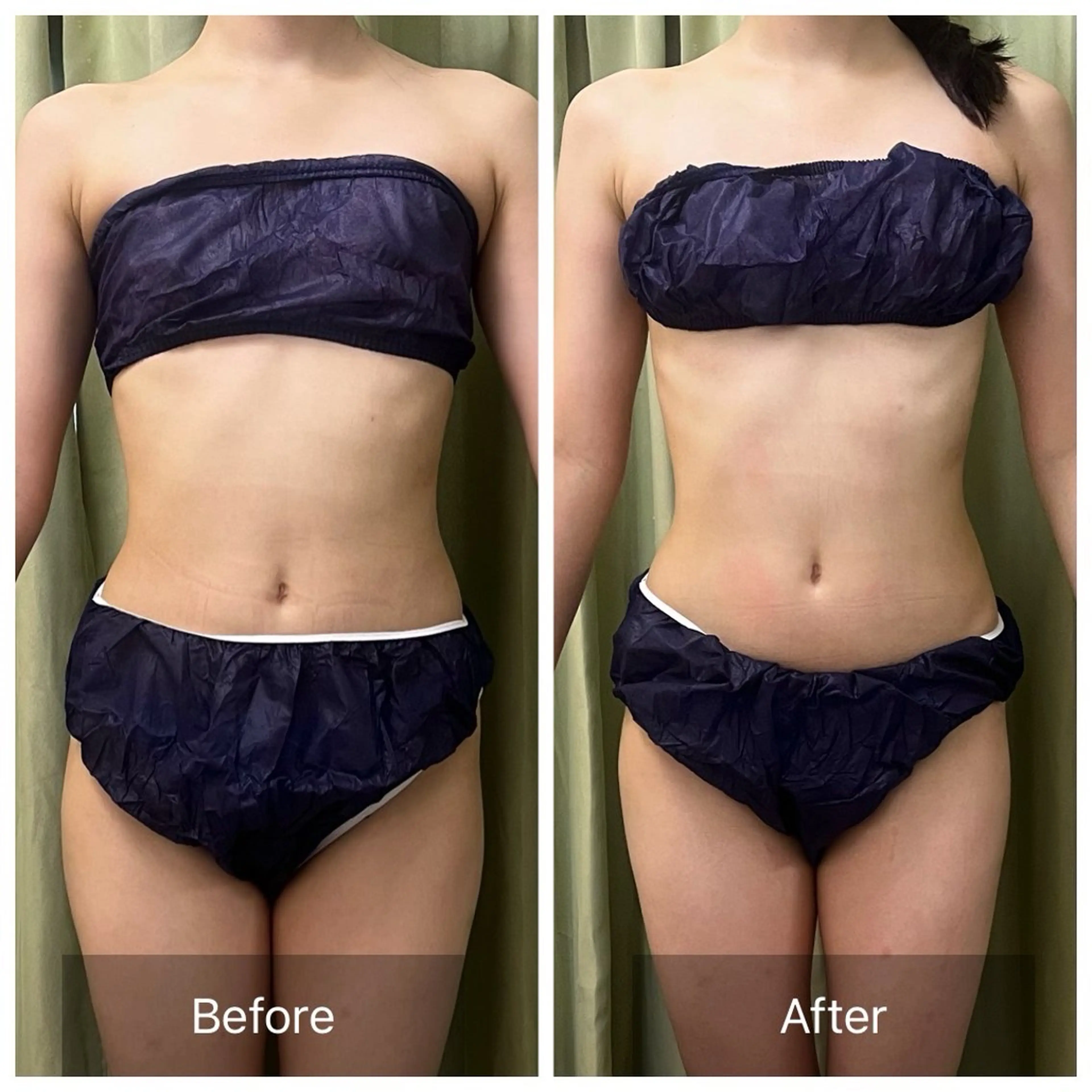 【痩身×疲労回復】痩身×筋膜×腸もみ×ヘッド💆♀️全身120分の写真