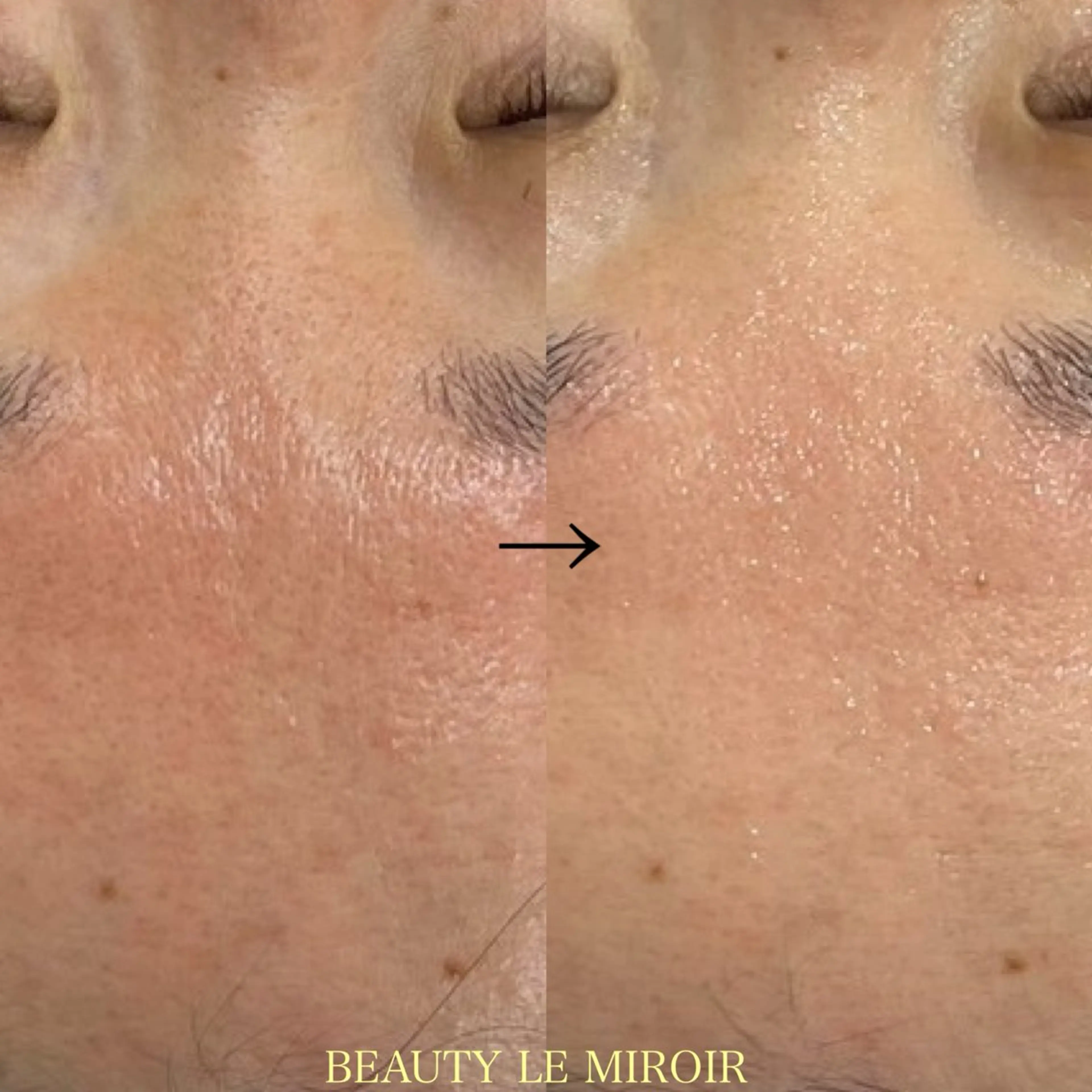 エステ ビューティー ミロワールのエステ・リラクイメージ