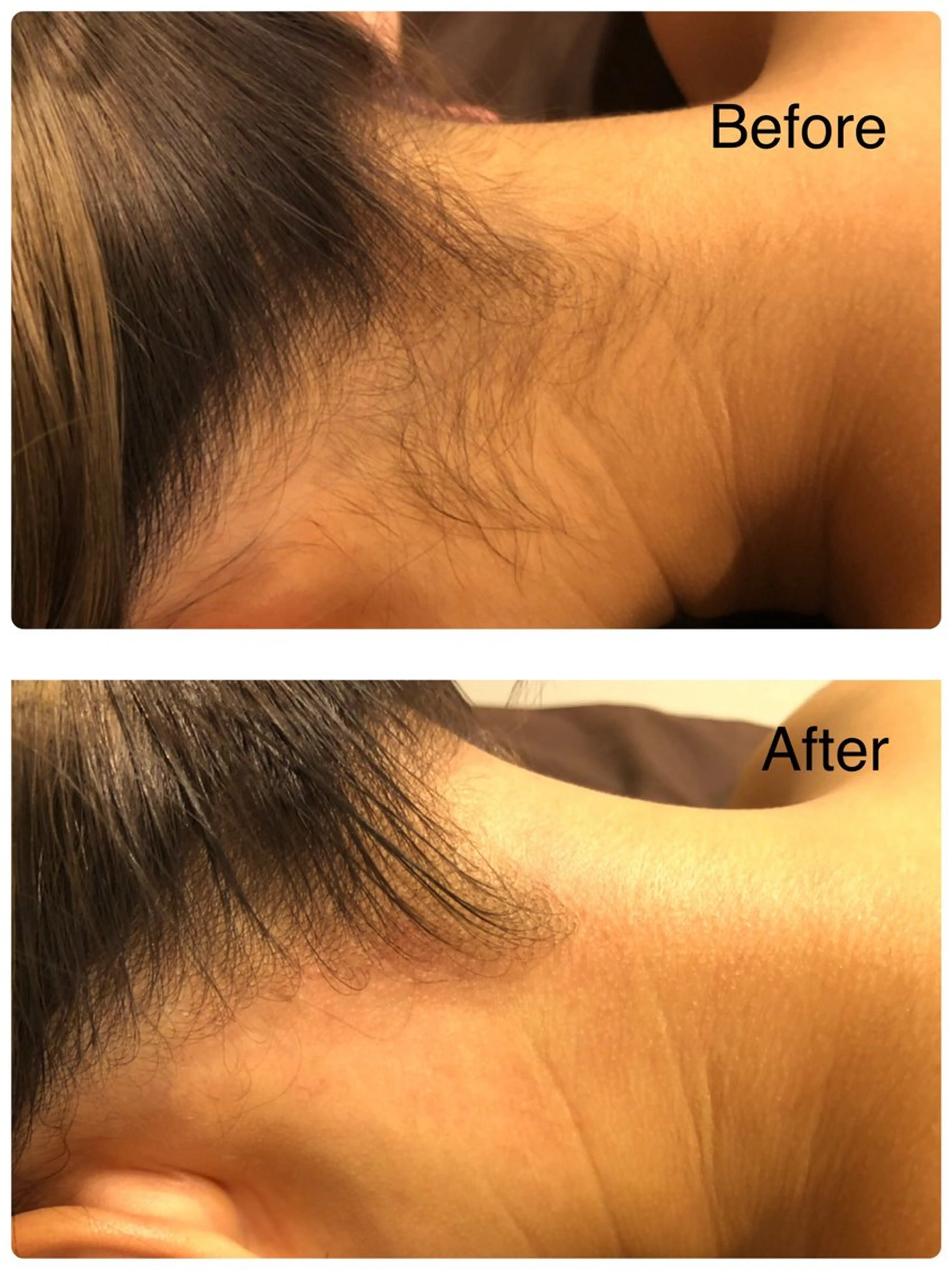 脱毛 加藤 葵のエステ・リラクイメージ