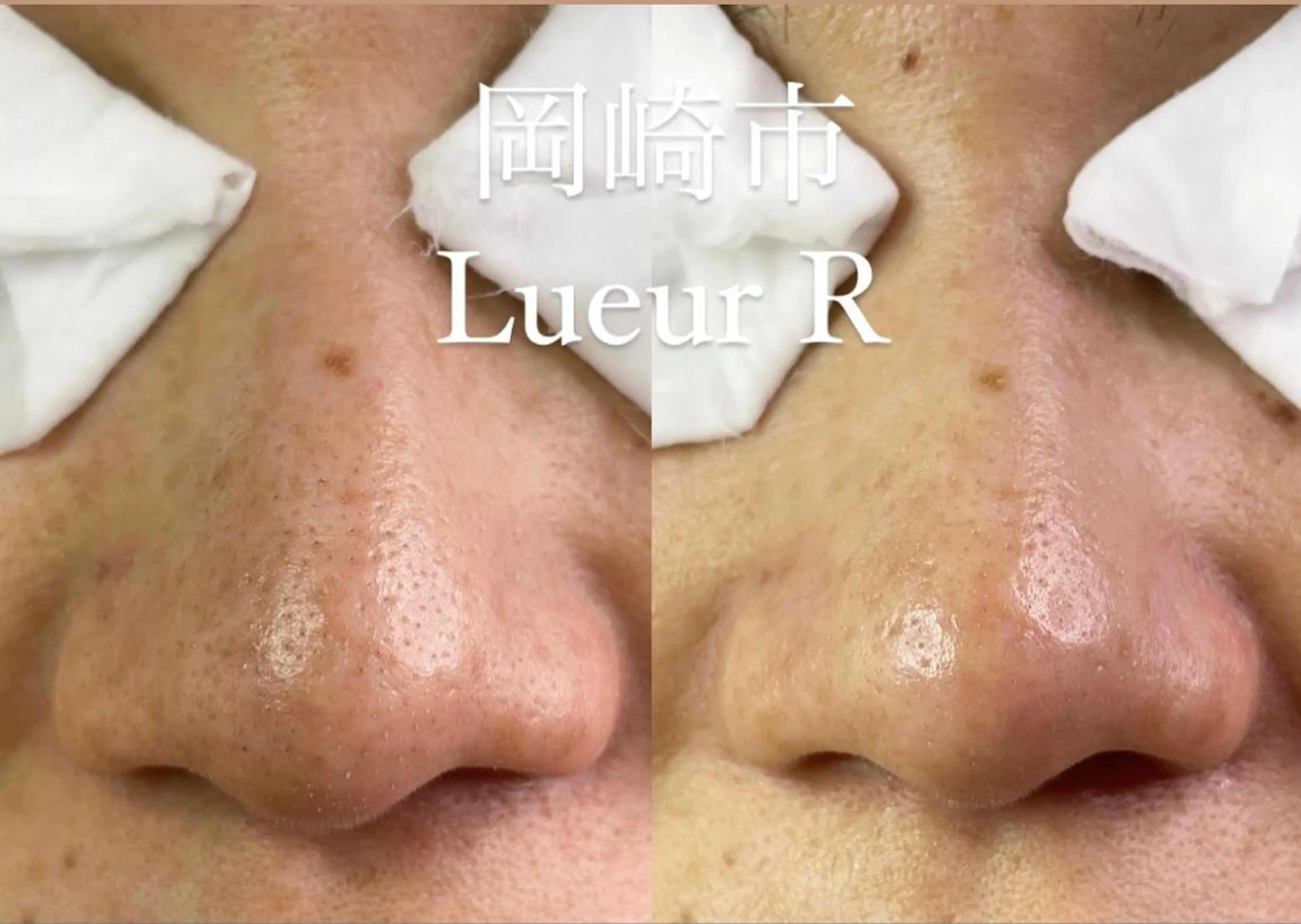 エステ 大久保 里奈のエステ・リラクイメージ