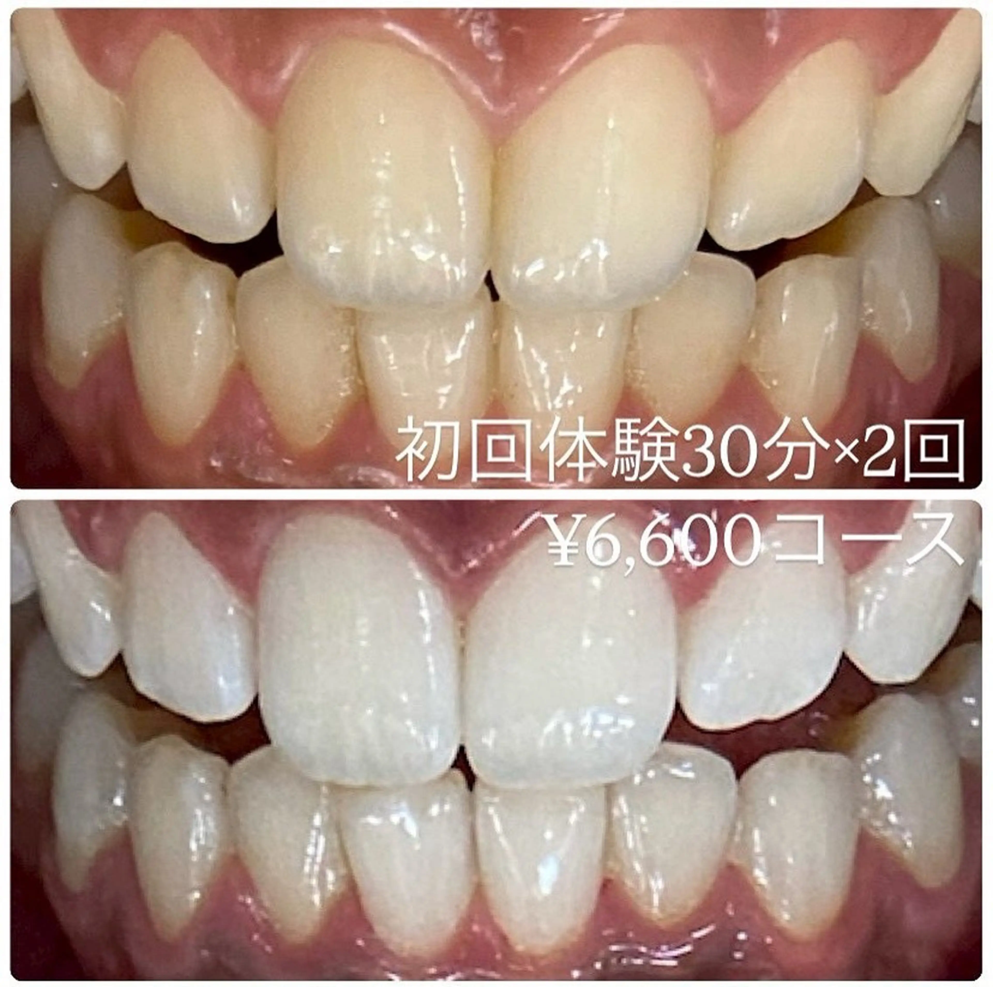 エステ ホワイトニングルーム 横浜店のその他イメージ