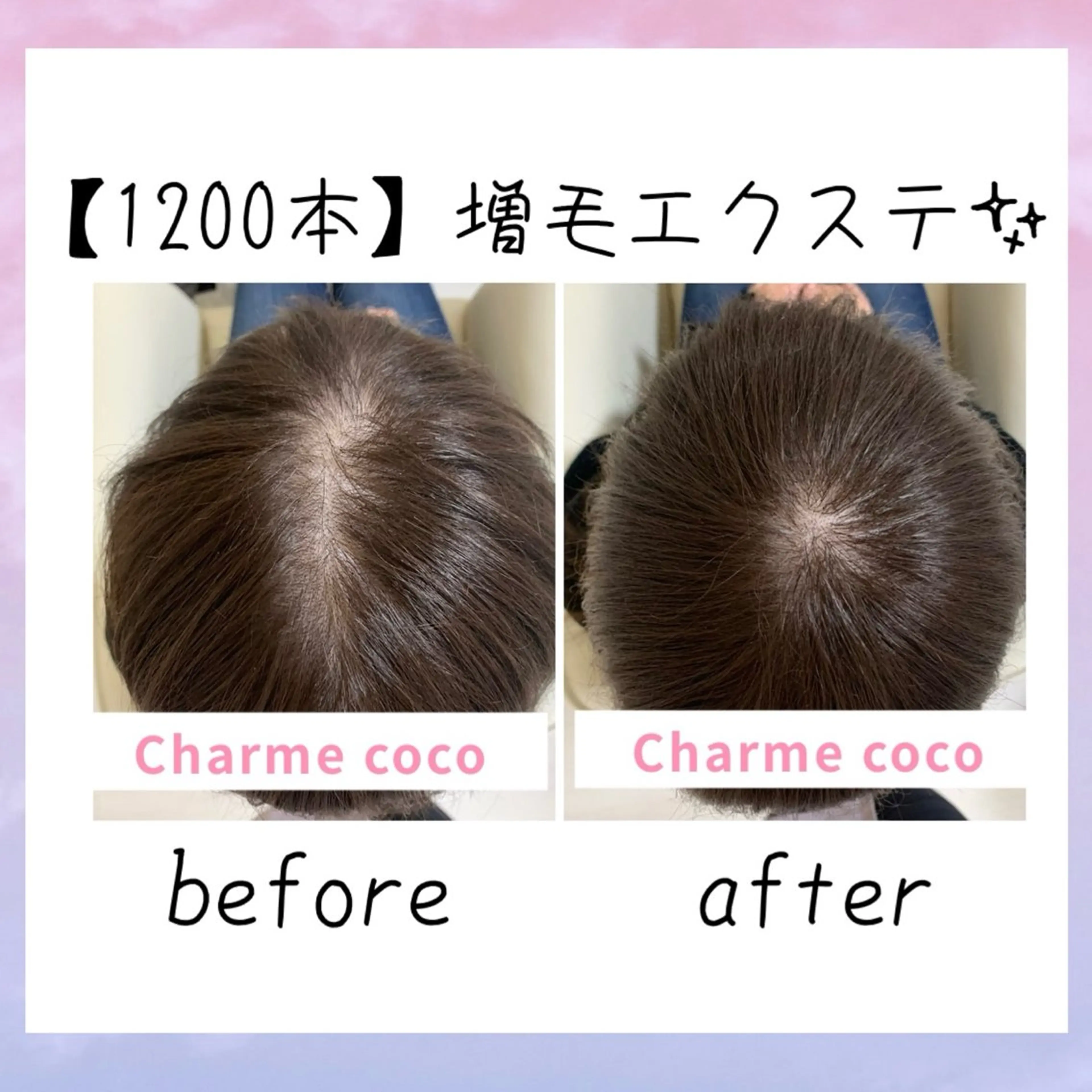 ミディアム メンズ エクステ 髪質改善 エクステ Charme coco(シャルム ココ)八尾店所属・ニキビ 毛穴ケア シャルム ココ みさのエステ・リラクイメージ
