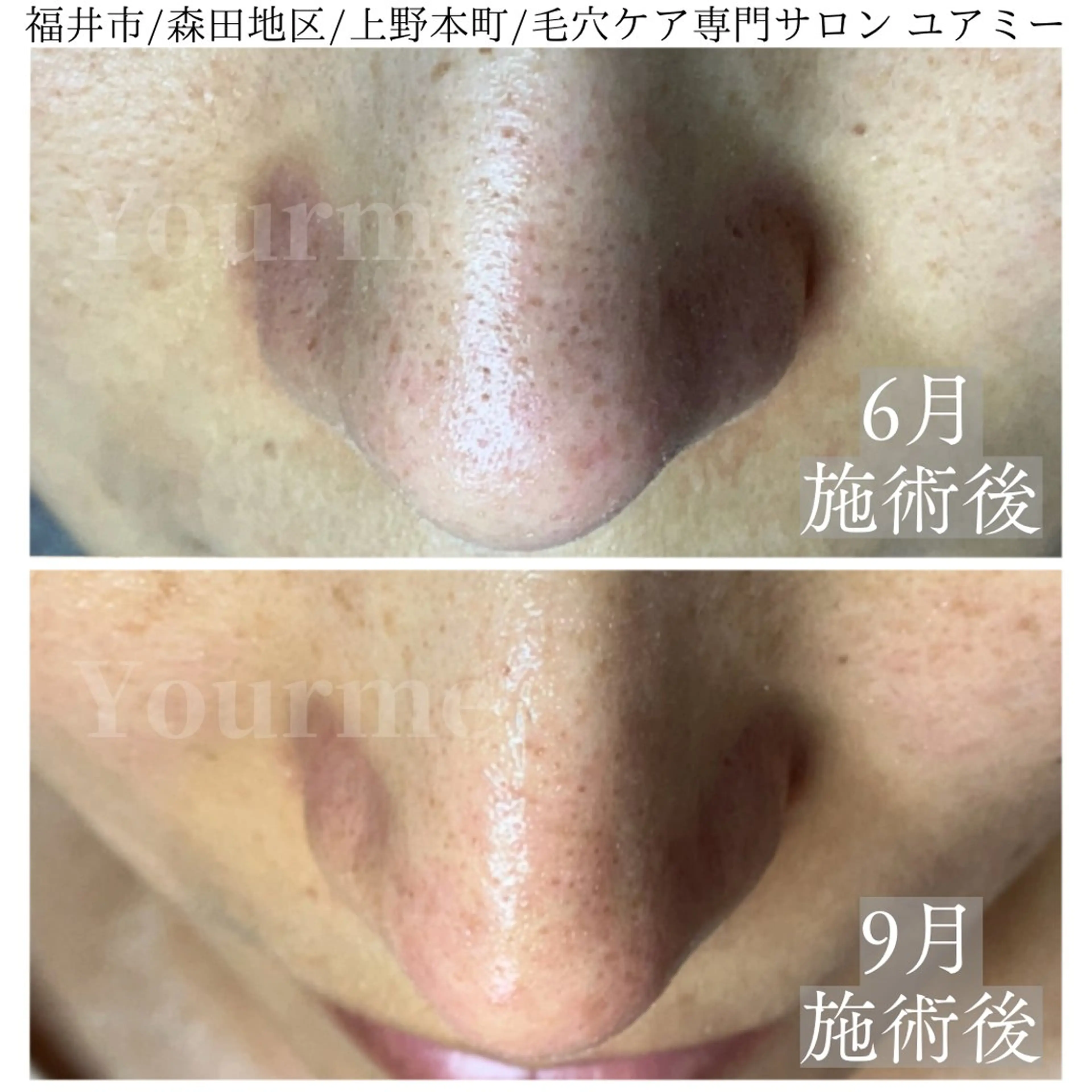 毛穴肌質ケアサロン Yourmeユアミーのエステ・リラクイメージ