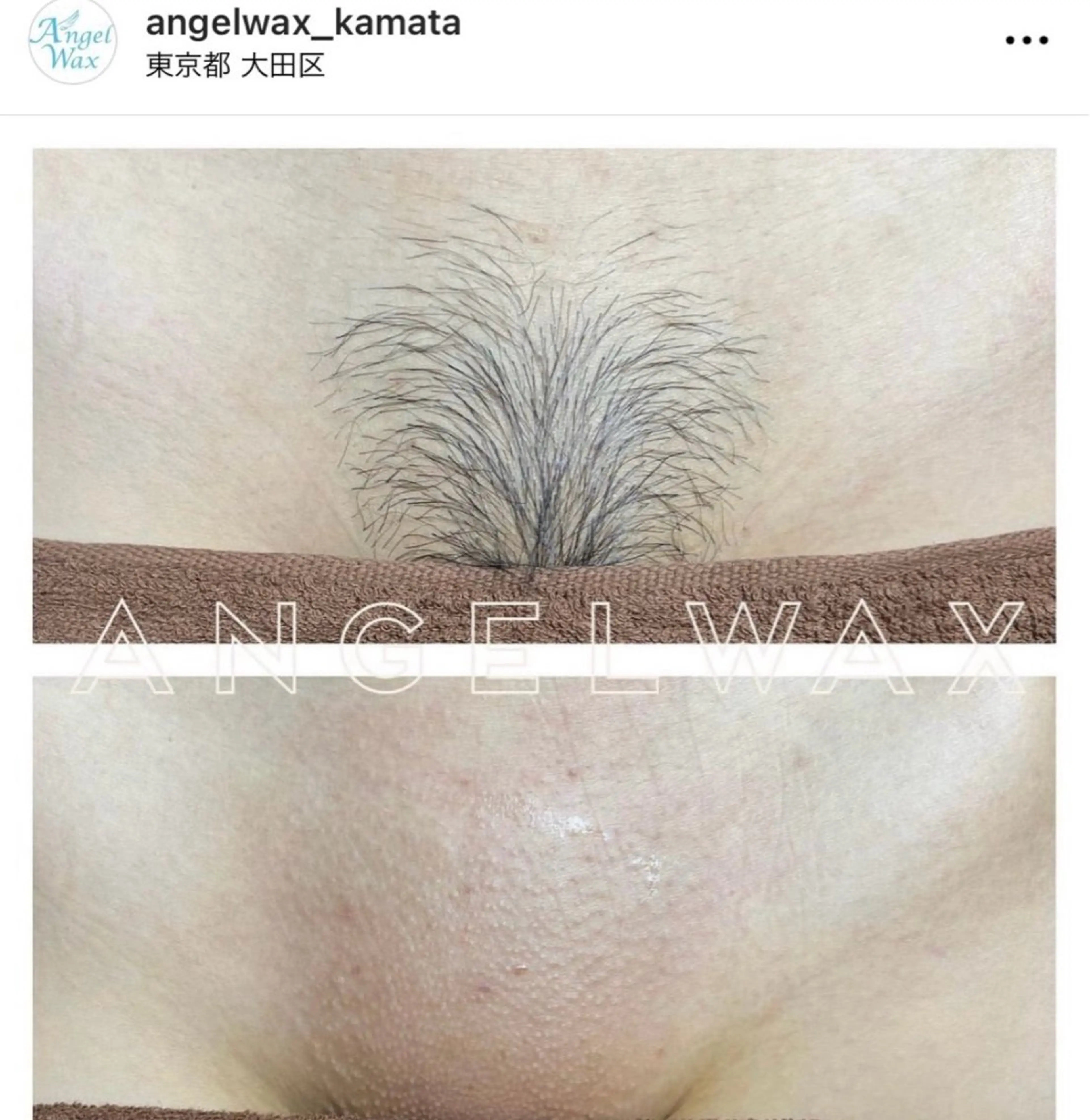 ワックス脱毛/光脱毛 🎀新宿駅徒歩5分のエステ・リラクイメージ