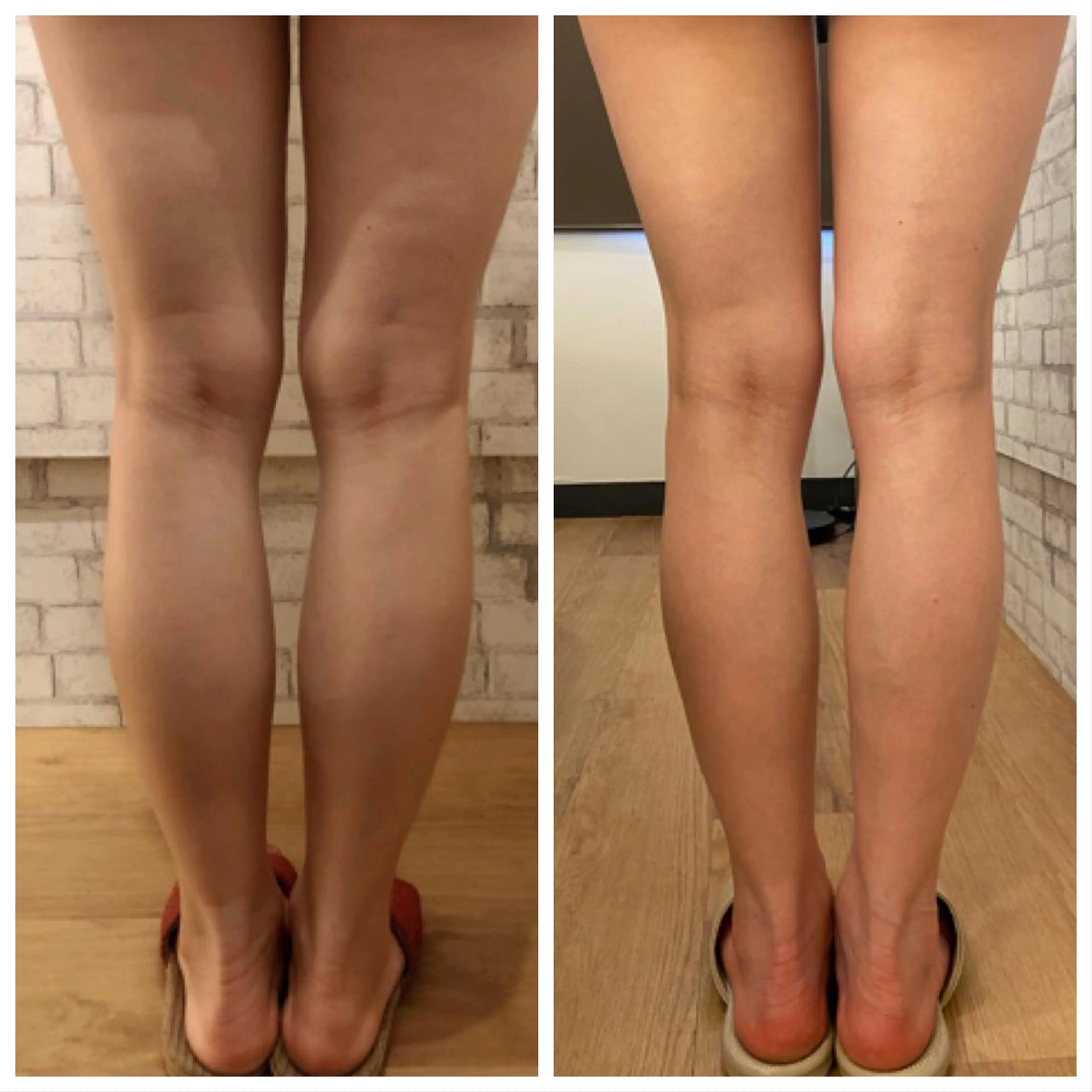 【小顔矯正】 salonaceのエステ・リラクイメージ