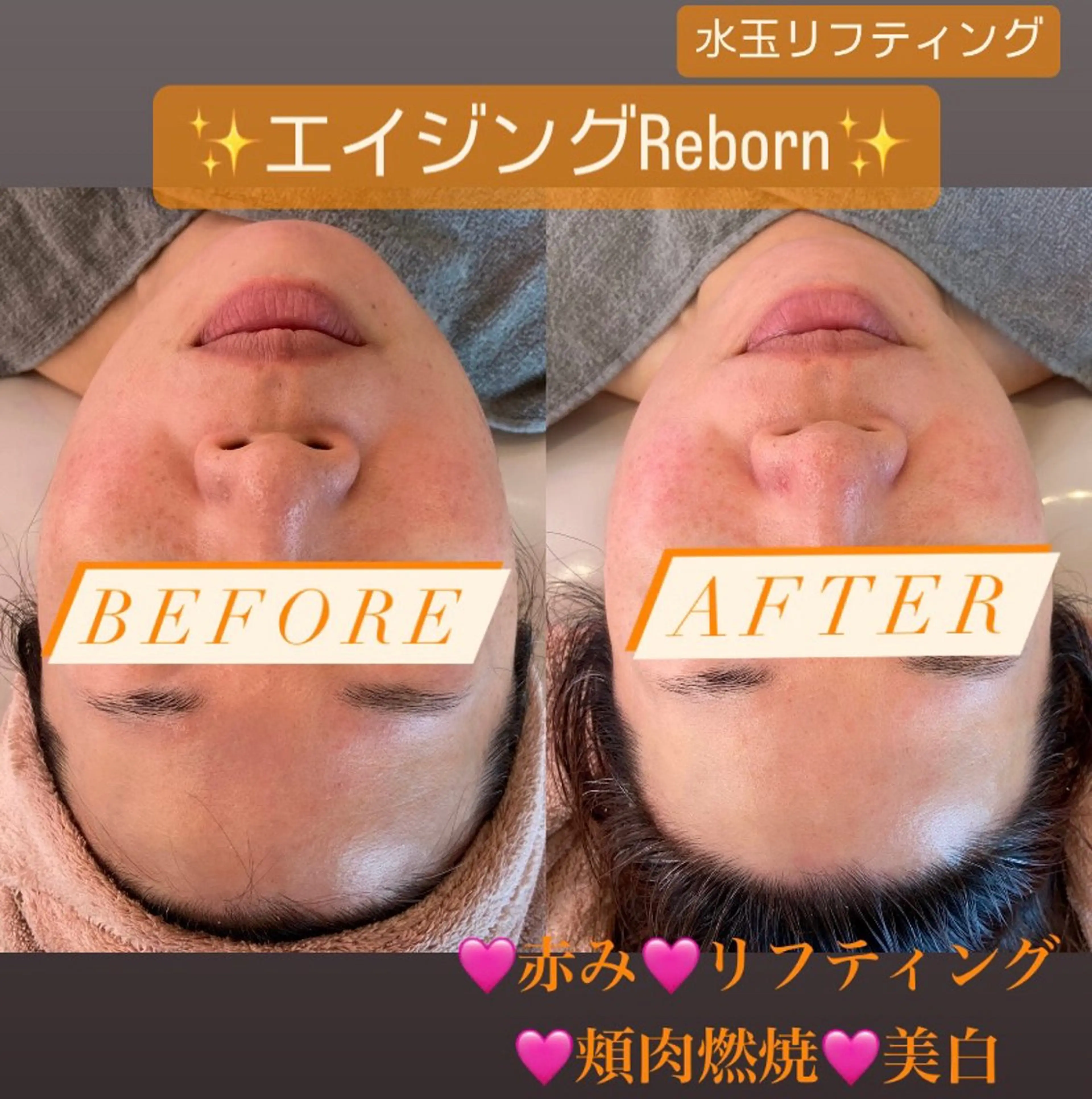 Tipani beaute'のエステ・リラクイメージ