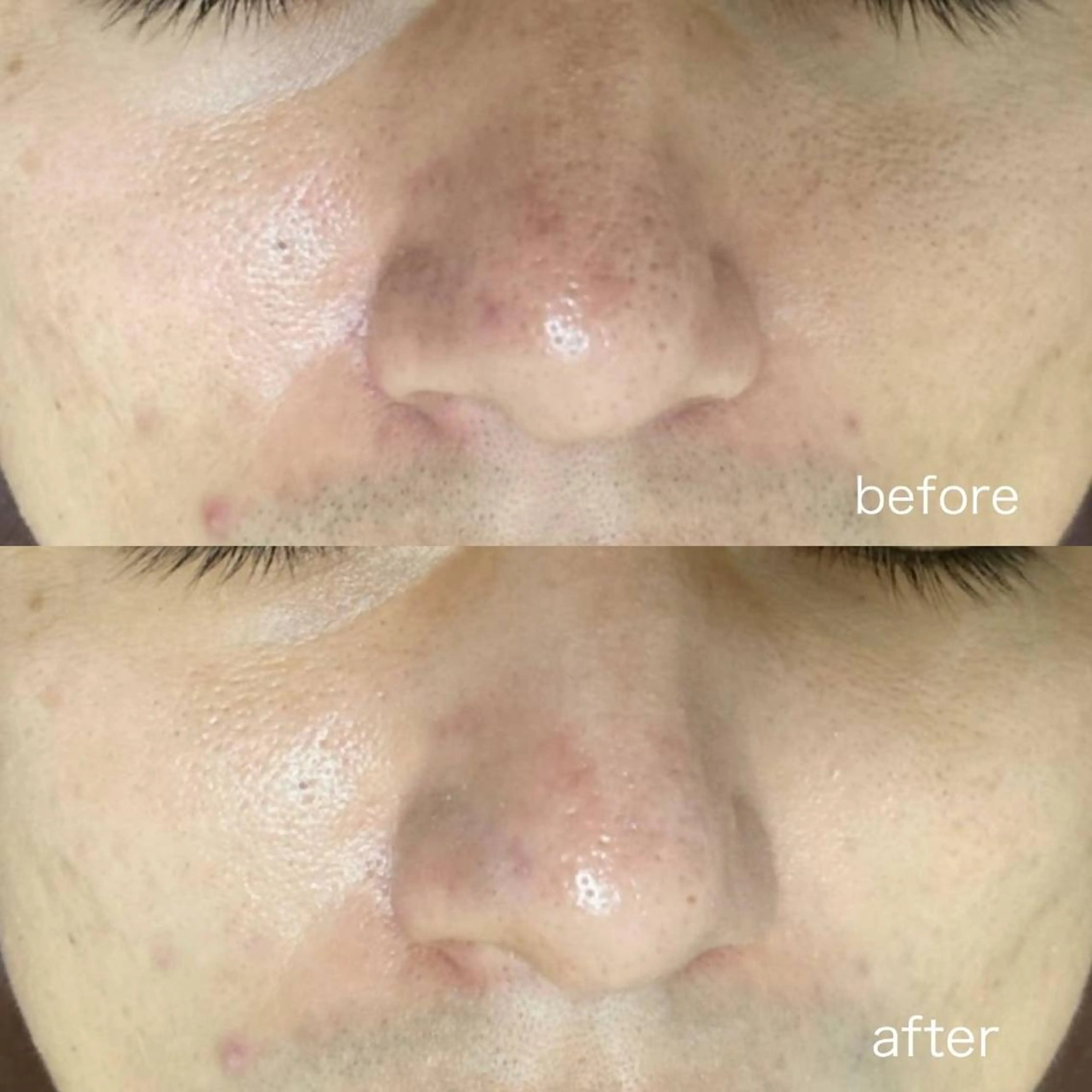 Yuuki 陶肌トリートメントのエステ・リラクイメージ