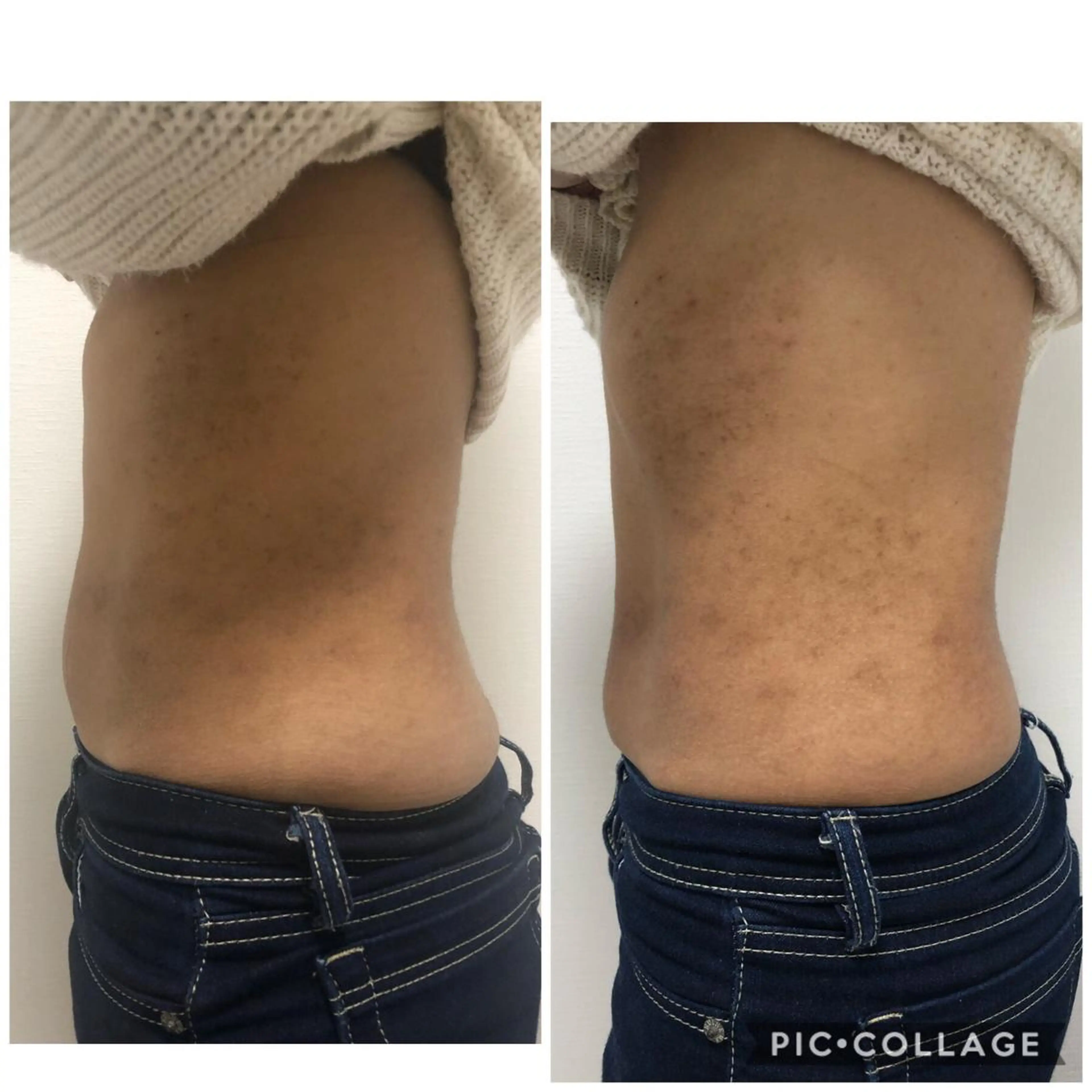 ESPOIR エスポワールのエステ・リラクイメージ