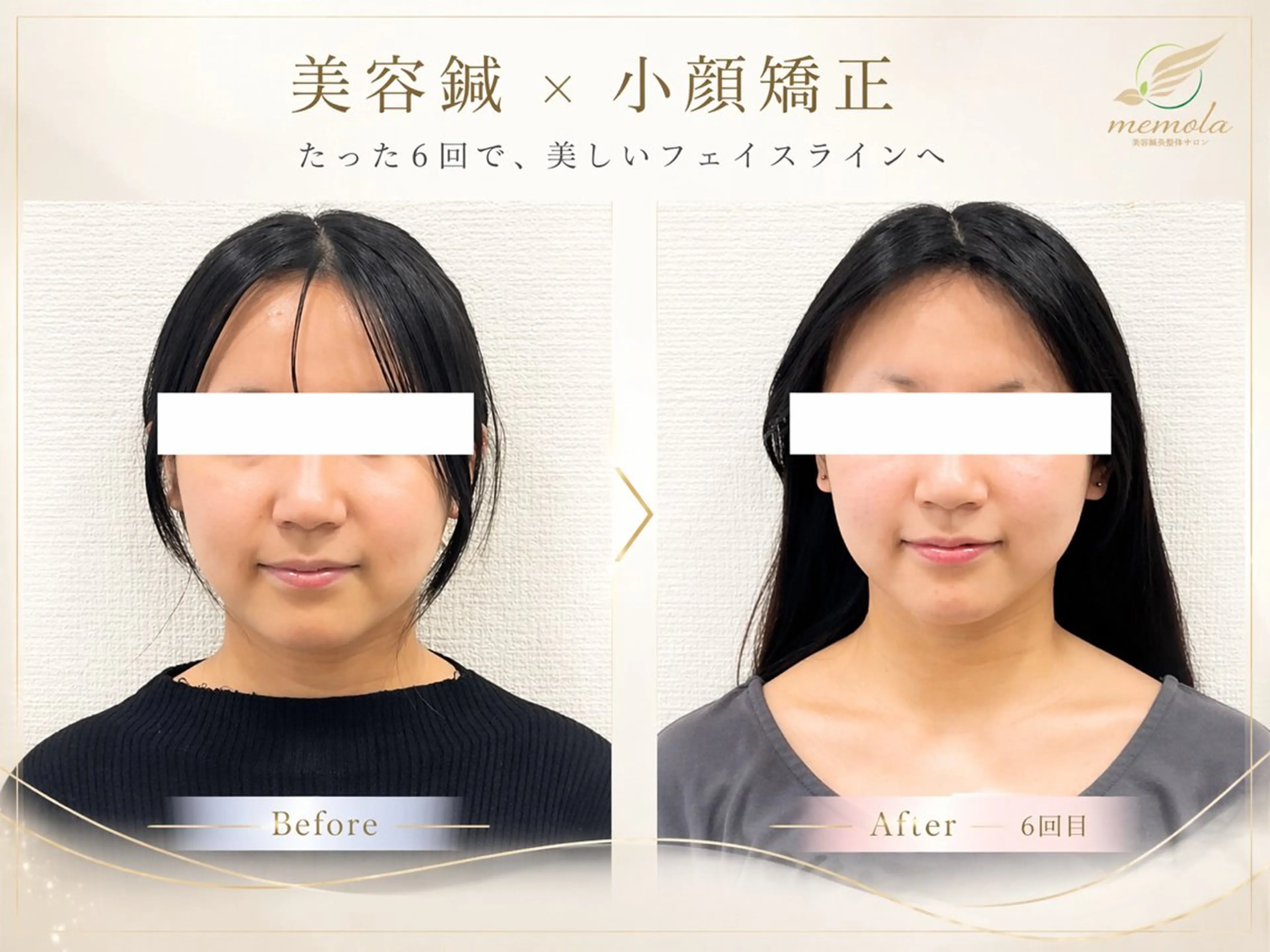 リラク 美容鍼×小顔×整体× ブライダル 大阪梅田のエステ・リラクイメージ