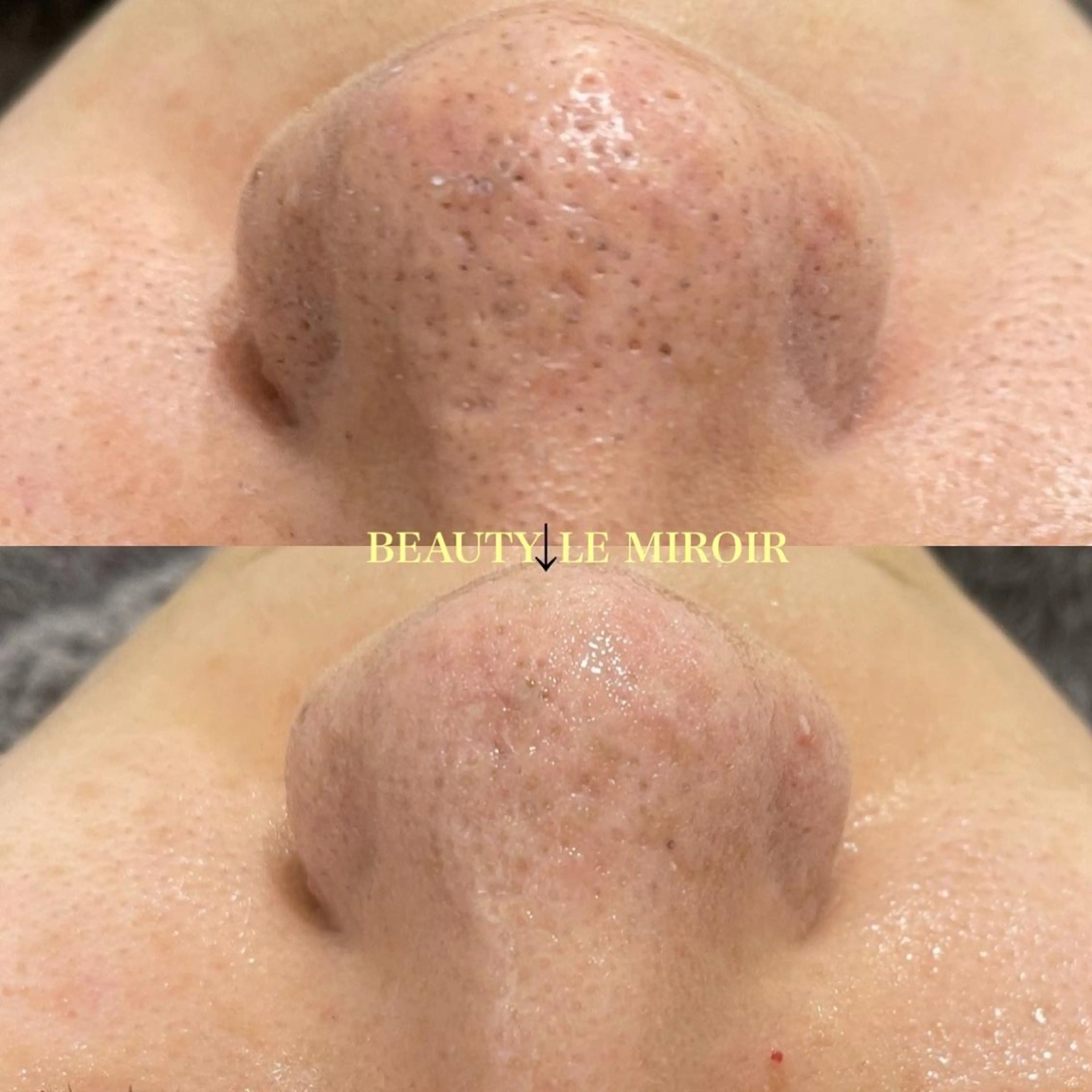 ビューティー ミロワールのエステ・リラクイメージ