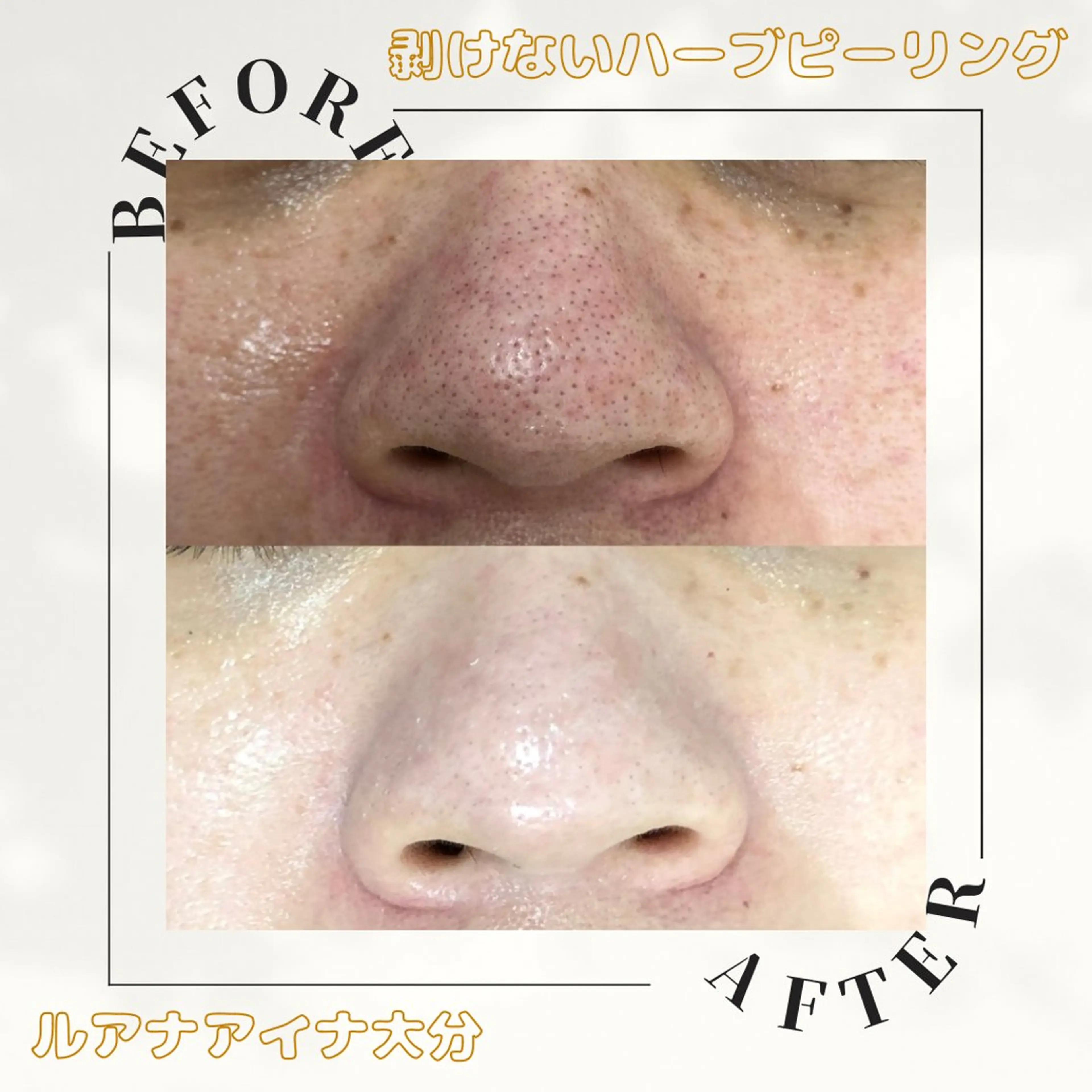 ルアナアイナ 大分のエステ・リラクイメージ