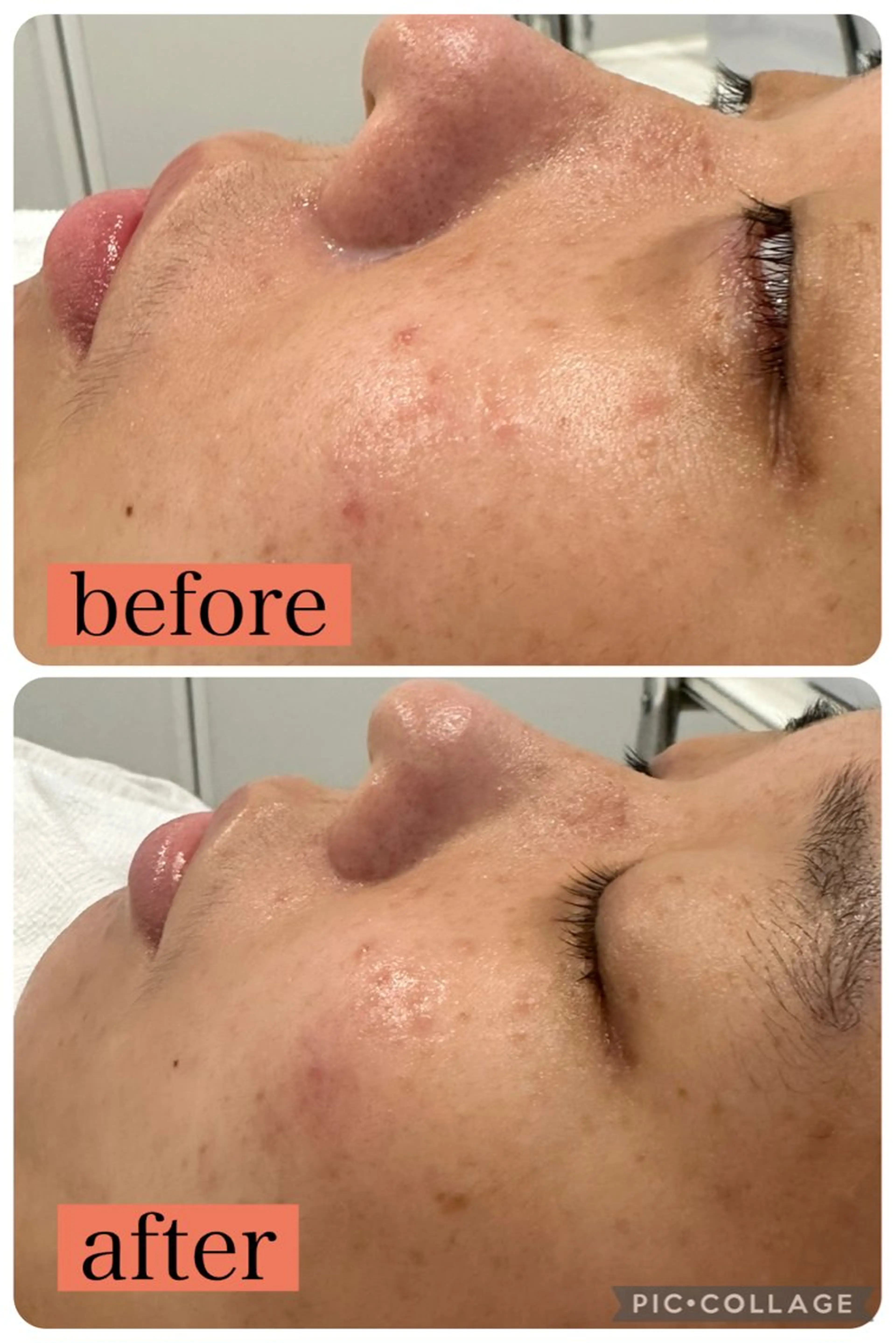 エステ EPIL 宮本のエステ・リラクイメージ