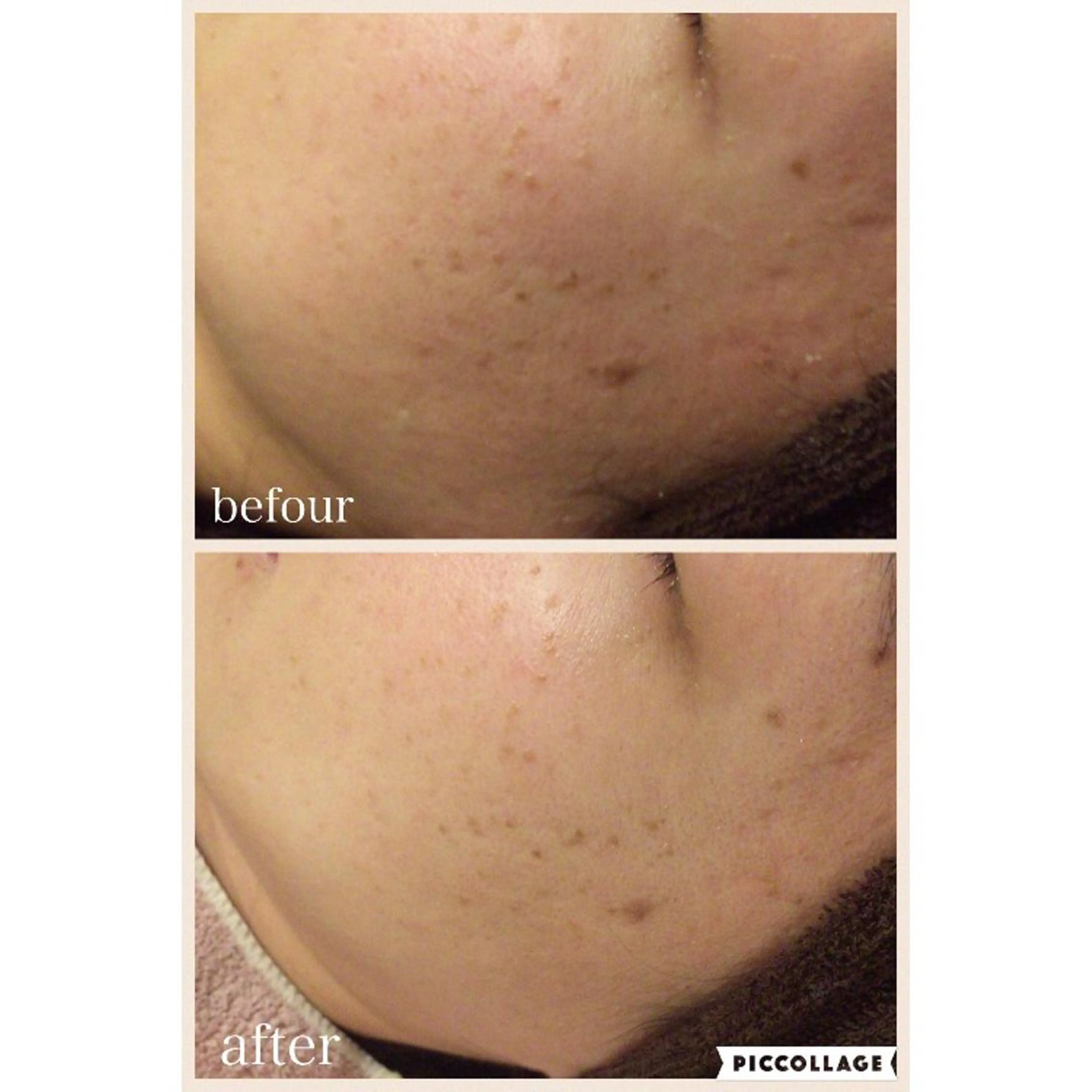 エステ リラク ニキビ跡専門サロン Ainaのエステ・リラクイメージ