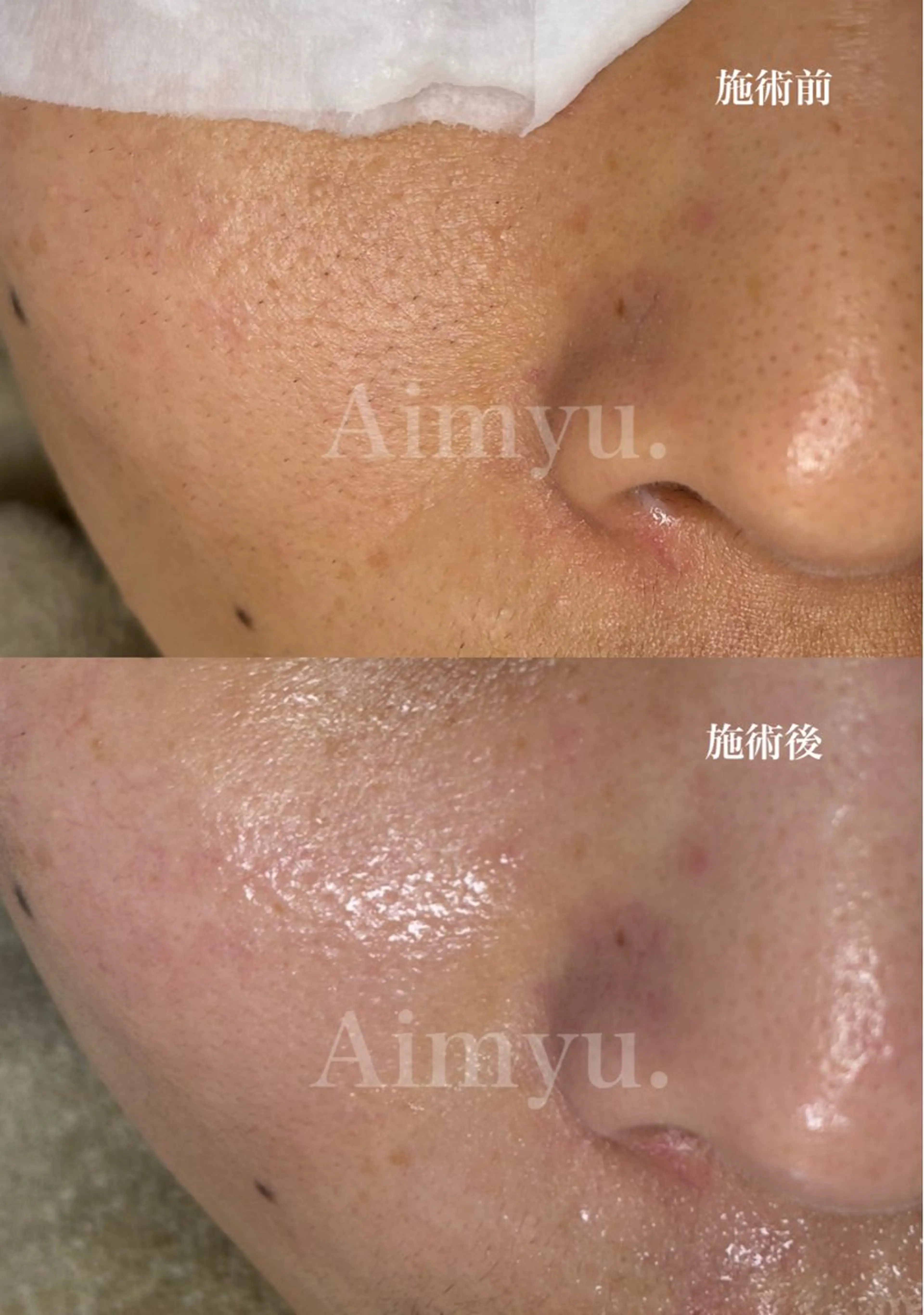 毛穴専門店アイミュー mamiのエステ・リラクイメージ