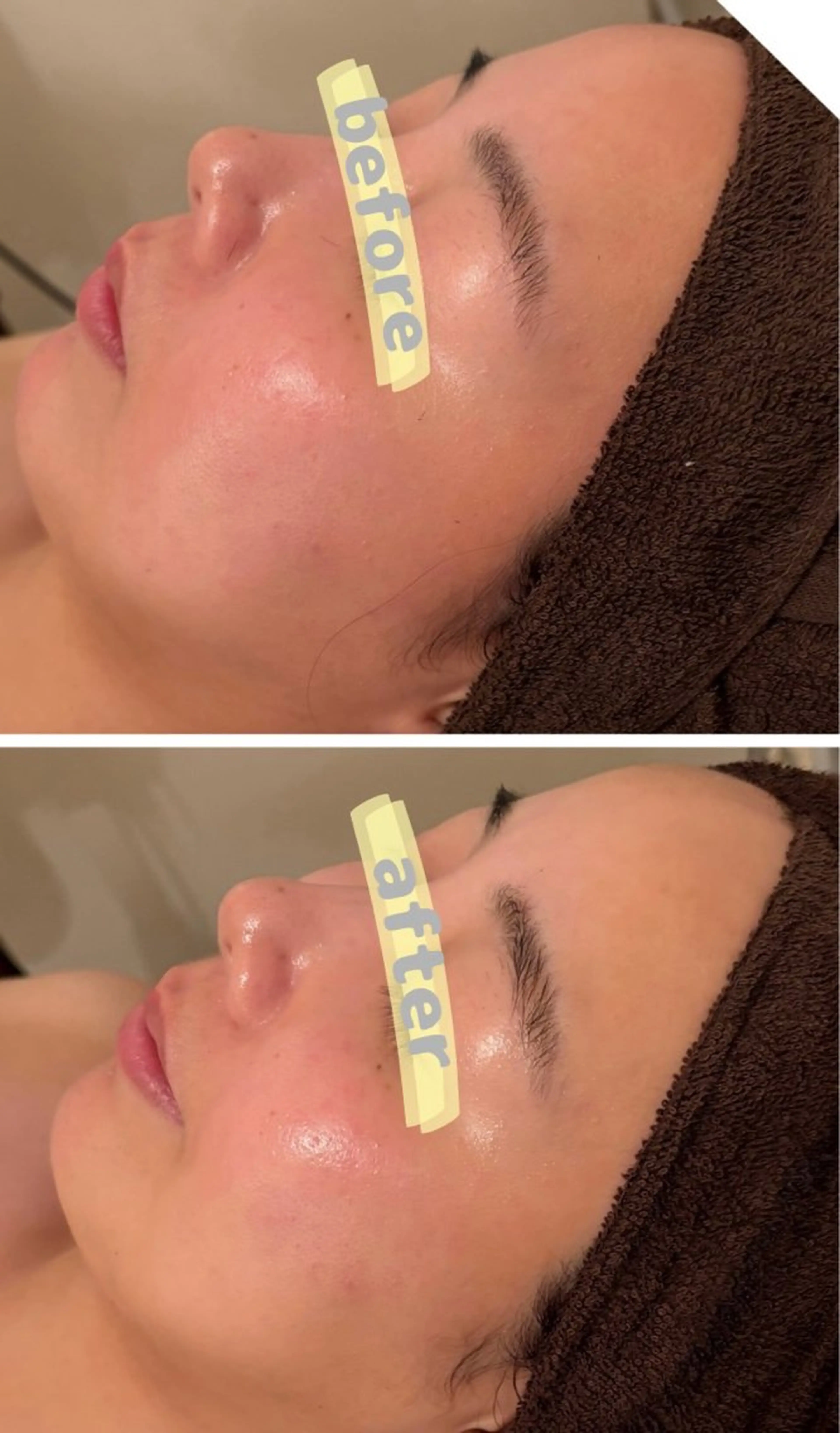 lucia  豊明 肌管理のエステ・リラクイメージ