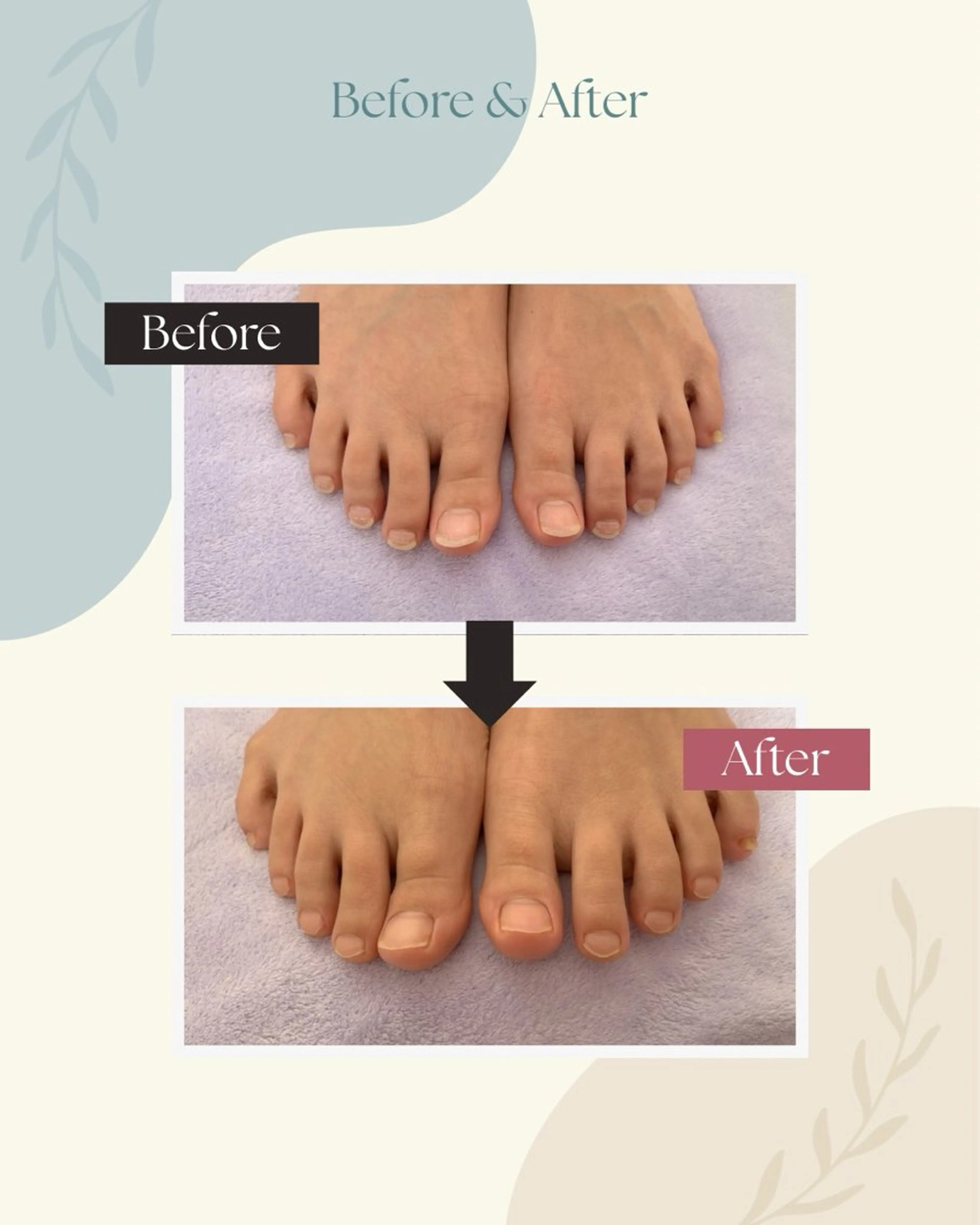 足トラブル専門 ニコルル金沢のエステ・リラクイメージ