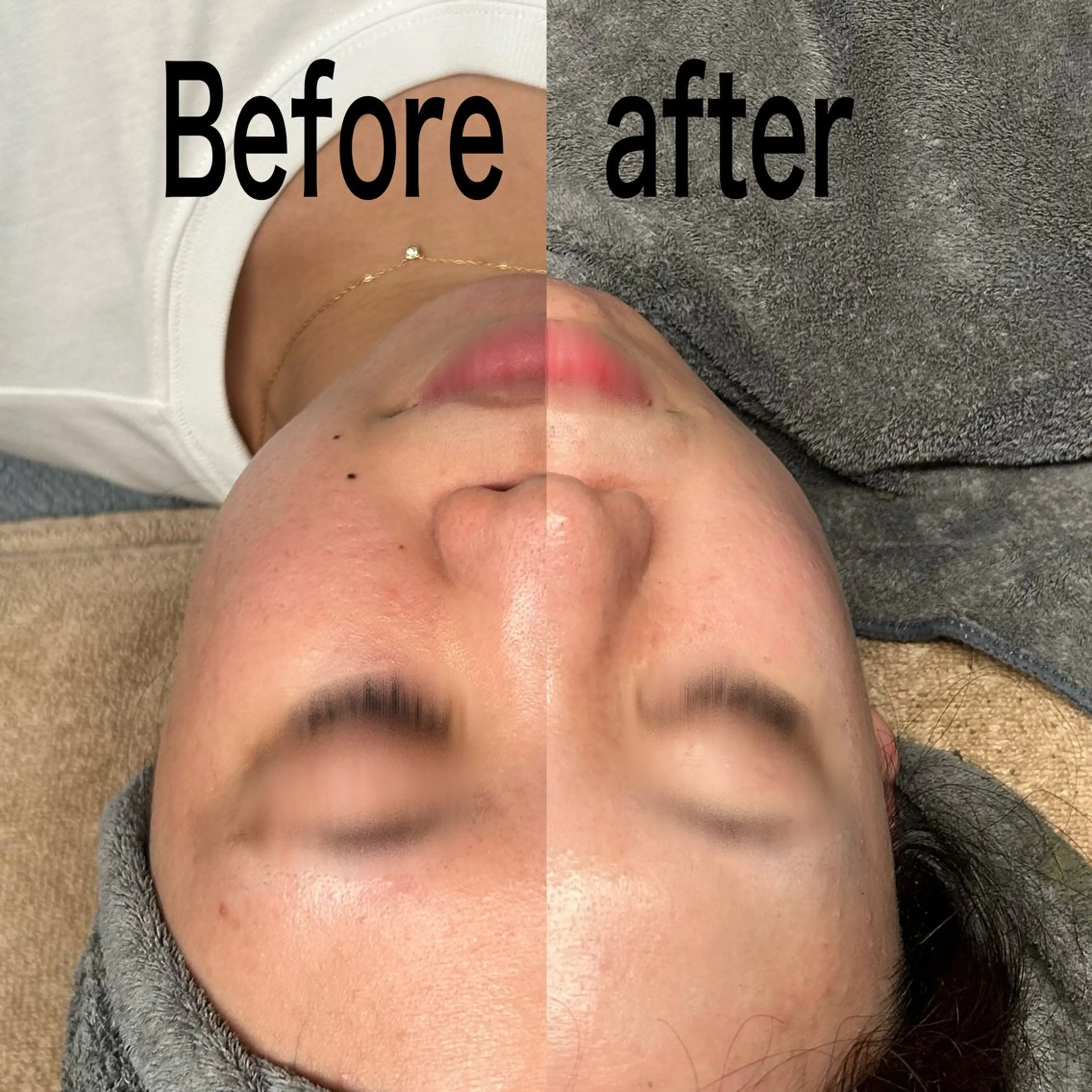 エステ Smoo アユミの眉毛・アイブロウイメージ