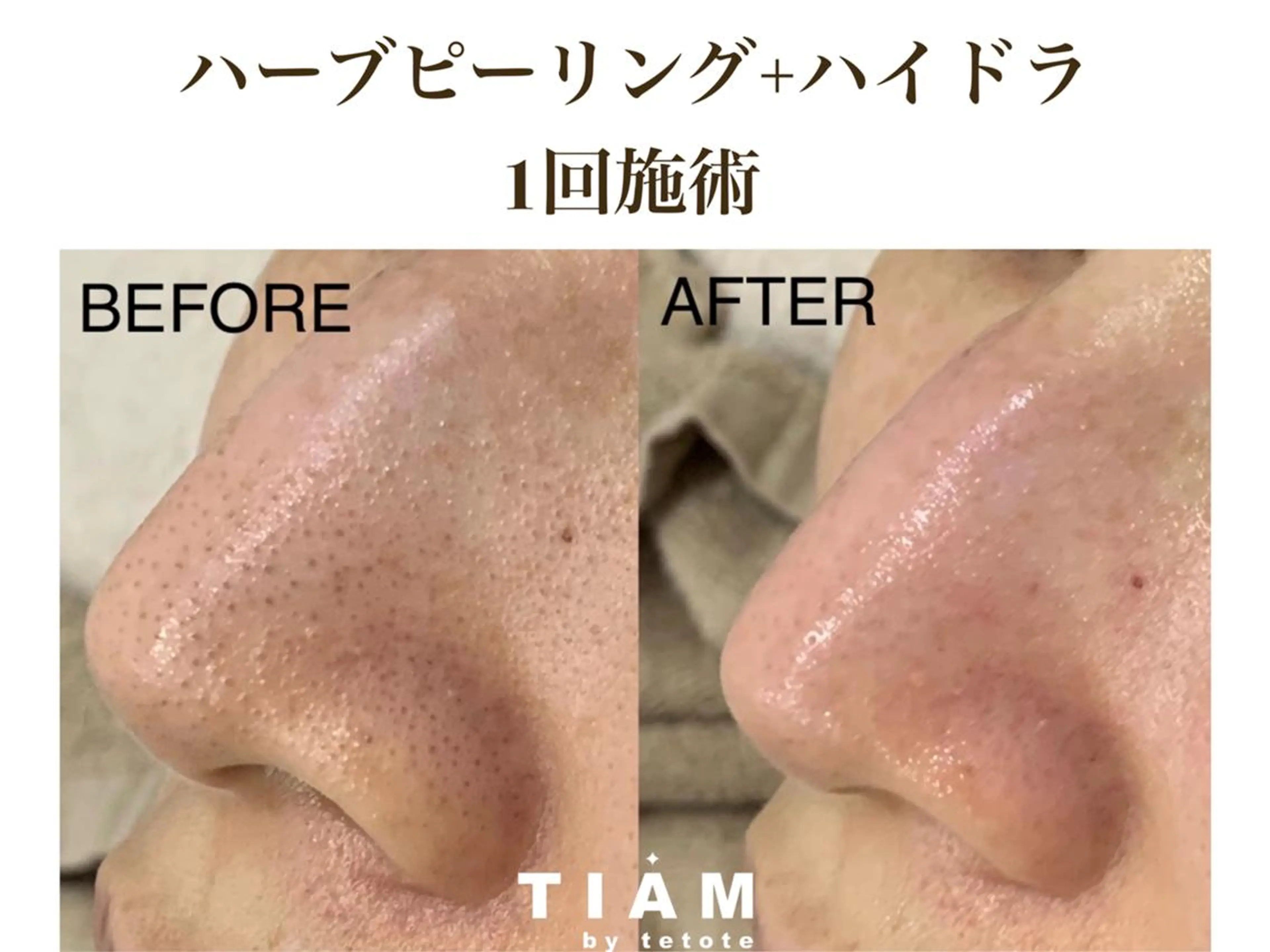 美肌サロンTIAM by tetoteのエステ・リラクイメージ