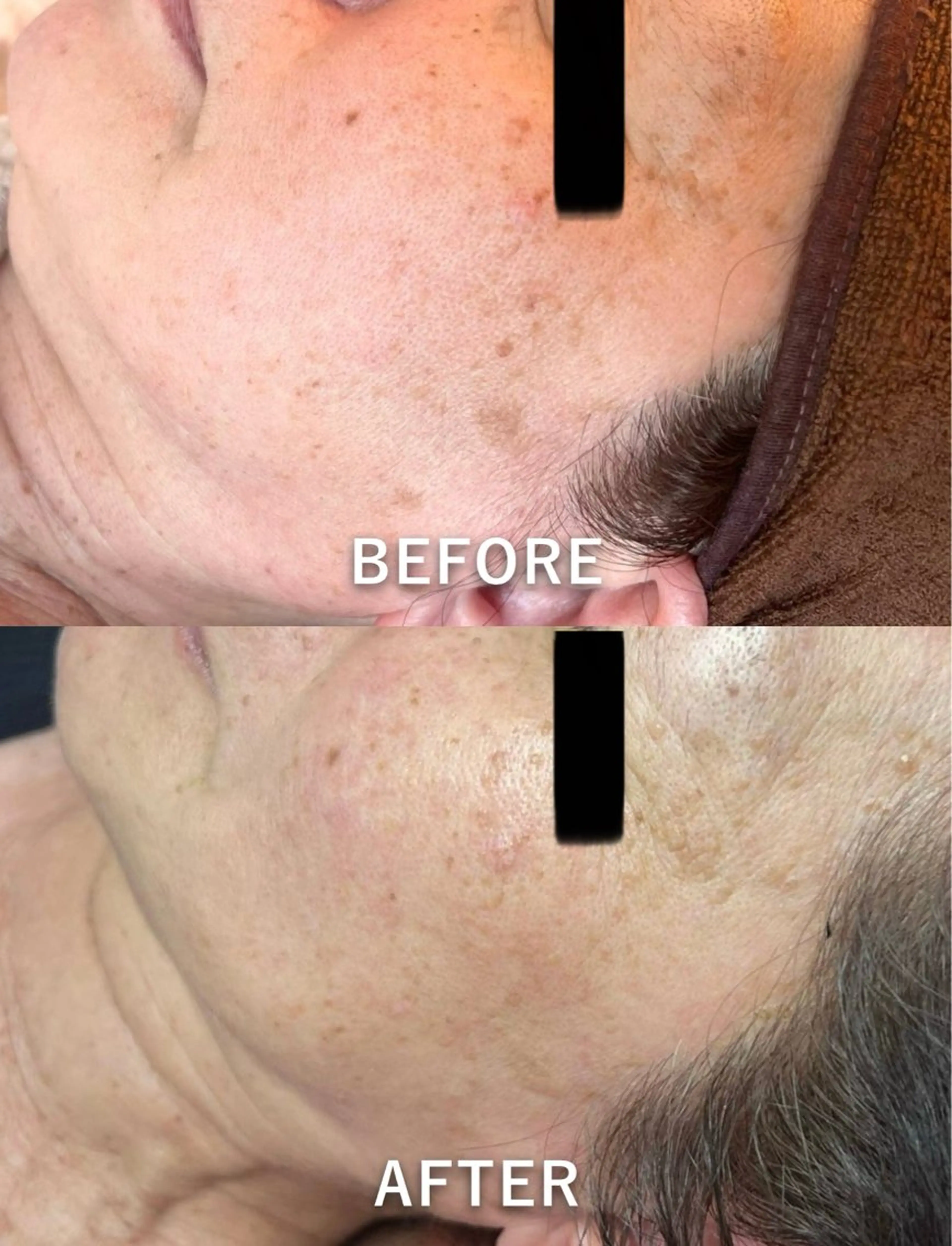 エステ 🌞シミケアサロン @SUNiko🌴のエステ・リラクイメージ