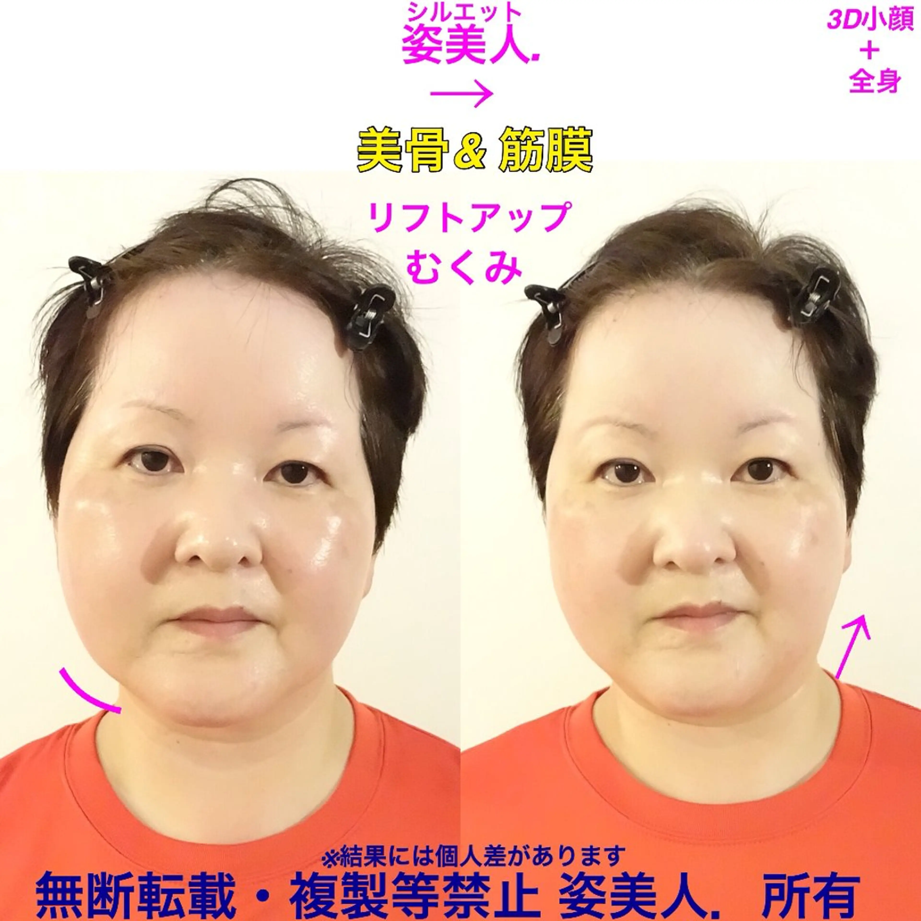 筋膜整体＆小顔矯正 　姿美人.シルエットのエステ・リラクイメージ