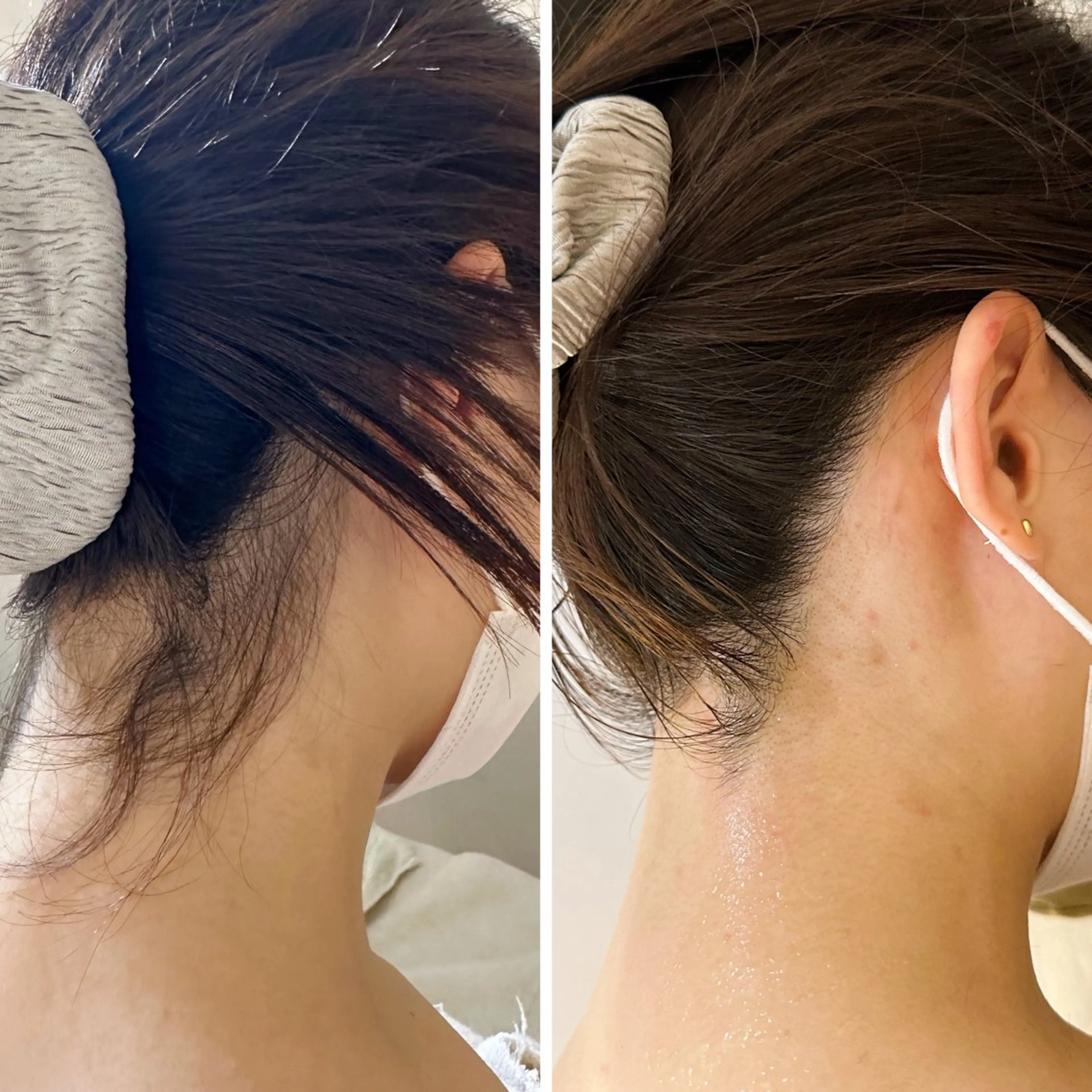 脱毛 うなじ脱毛/美肌脱毛 LABELのエステ・リラクイメージ