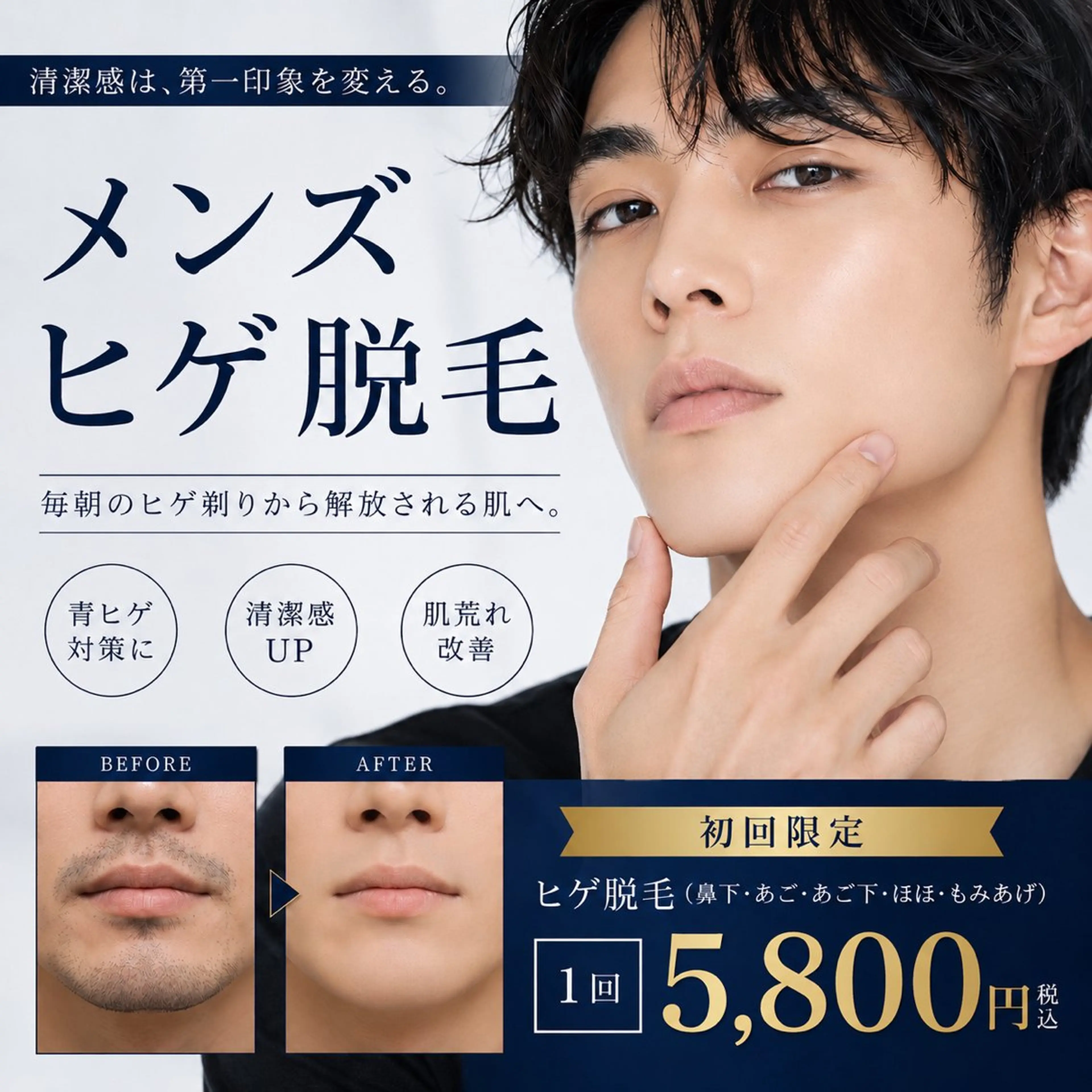 メンズヒゲ脱毛◎青ヒゲ対策の写真
